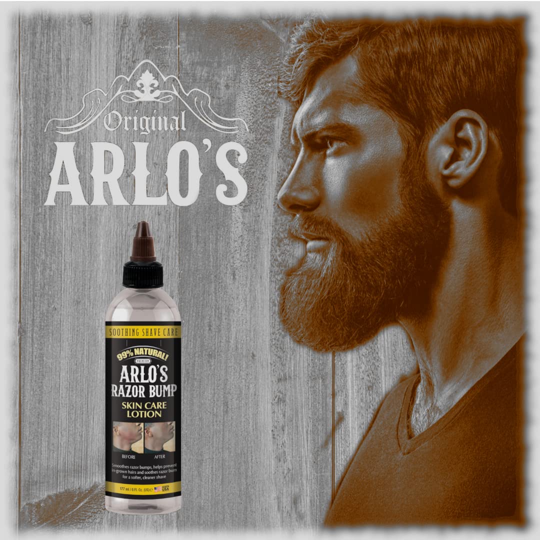 Arlo's Razor Bump Skin Care Lotion 6 oz. Beauty & Personal Care Arlo's