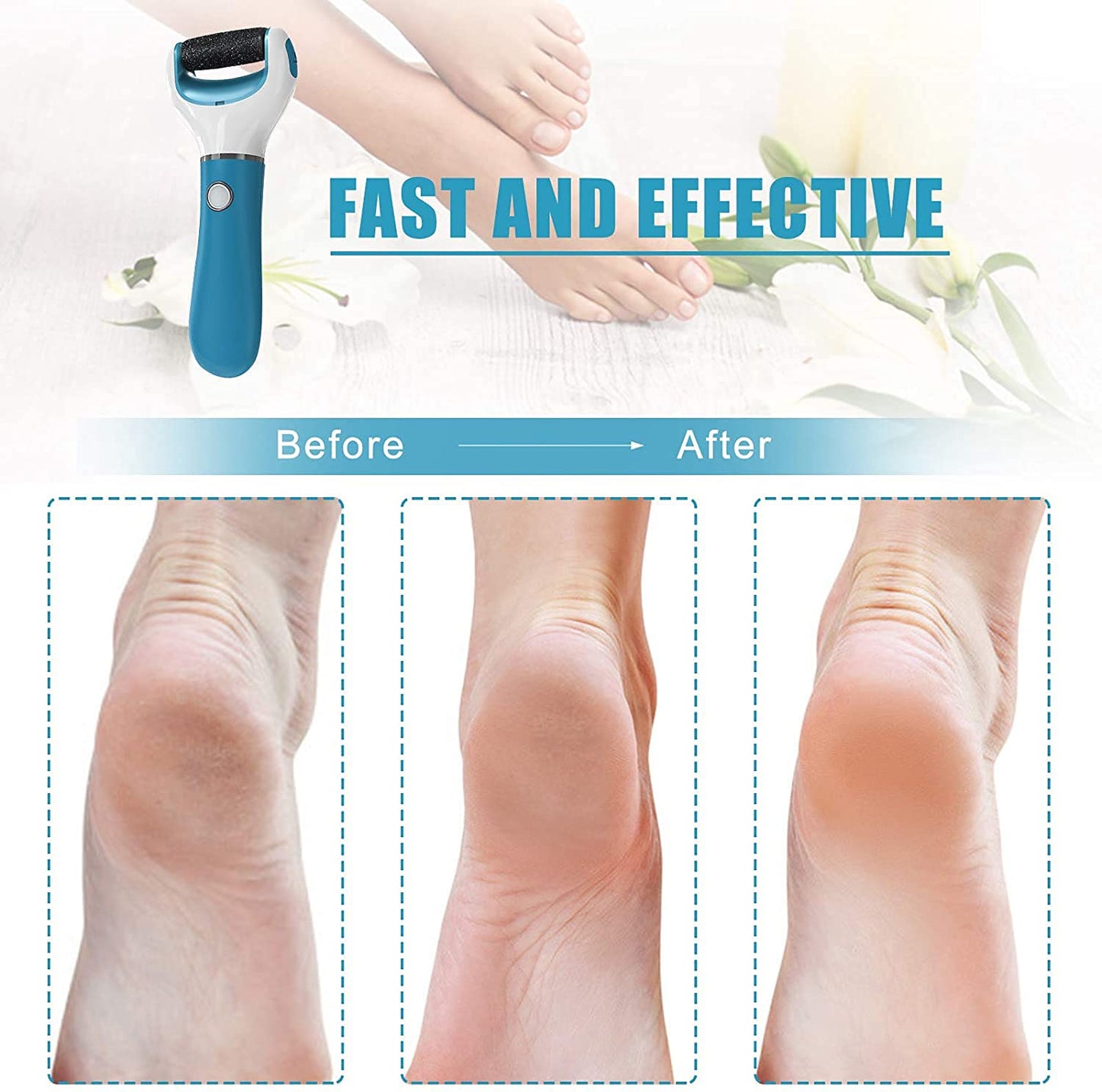 Electric Foot File Callus Remover Professional, 2-Speed Rechargeable Pedicure Tool for Remove Calluses, Dry, Hard, Dead, Cracked Skin, Includes 2 Beauty & Personal Care Pretfy