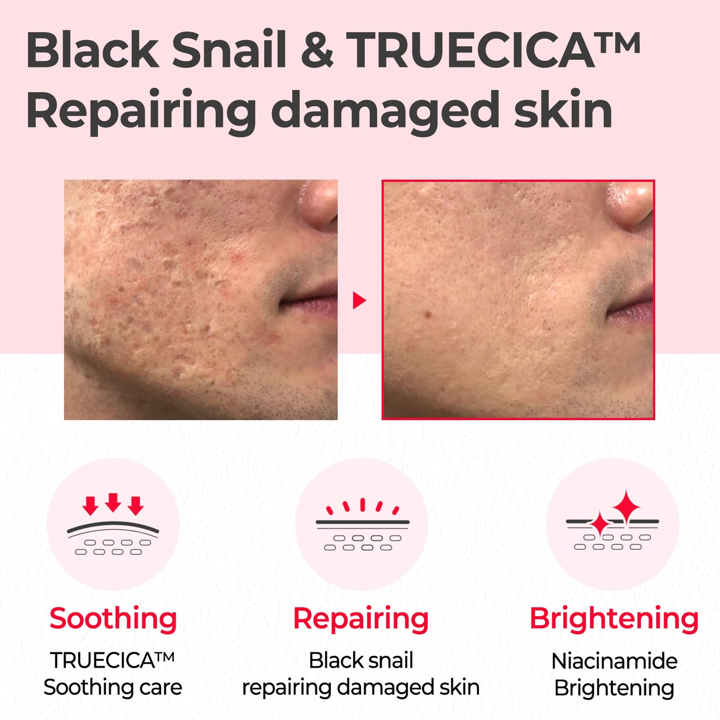 SOME BY MI Snail Truecica Miracle Repair Toner - 4.6Oz, 135ml - Made from Snail Mucin for Sensitive Skin - Daily Repair Face Toner with Skin Texture Beauty & Personal Care SOME BY MI