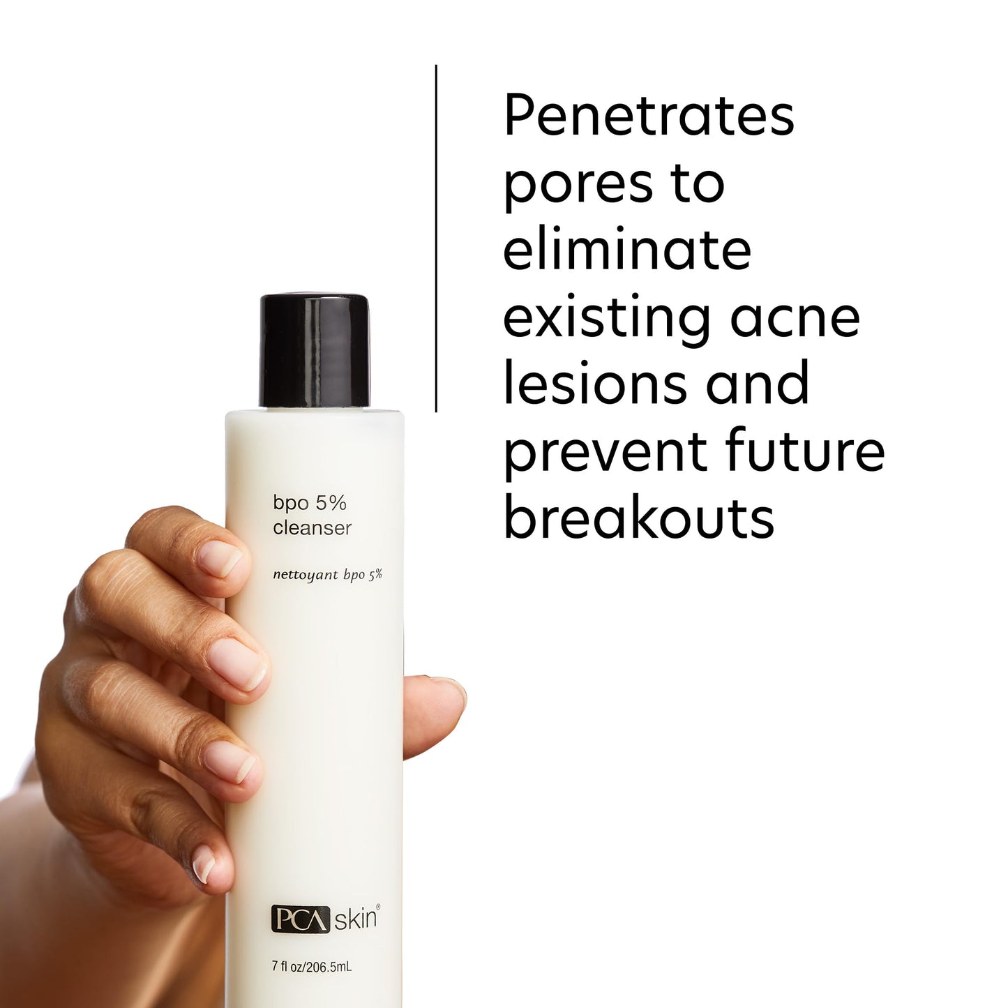 PCA SKIN 5% Benzoyl Peroxide Face Wash, Foaming Acne Facial Cleanser for Oily and Acne Prone Skin, Eliminates Existing Acne and Helps Prevent Future Beauty & Personal Care PCA SKIN