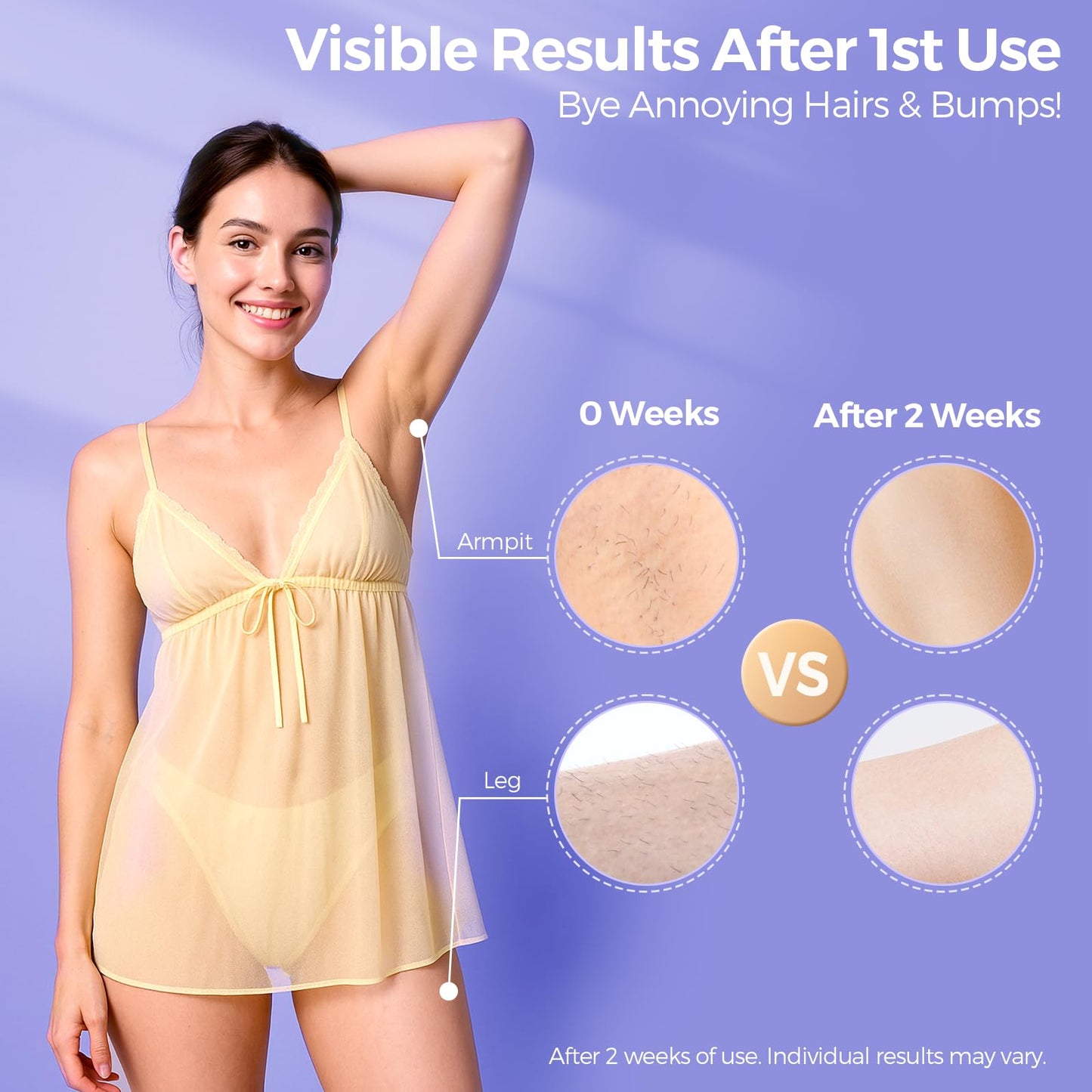 2026 Upgraded Laser Hair Removal with 5? Ice Cooling, Painless IPL Laser Hair Removal Device for Women & Men, 999,999 Flashes, 5 Levels, 2 Modes Beauty and Personal Care TAKSOME