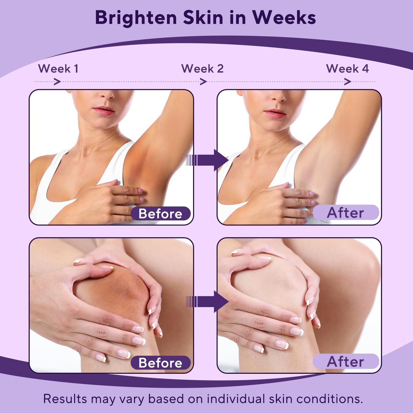 Skin Bleaching Cream, Skin Lightening Cream with Vitamin C for Intimate Areas, Dark Spot Remover for Body, Sensitive, Face, Intimate Areas Underarms Beauty & Personal Care GEAFAW