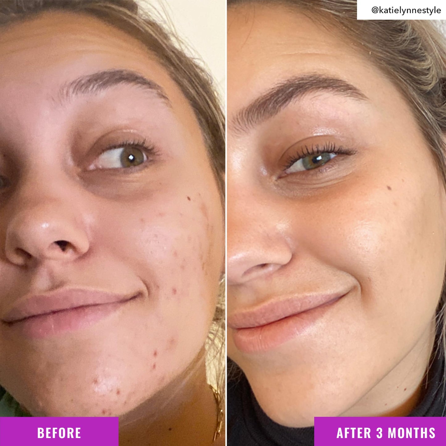 Good Molecules Niacinamide Brightening Toner - Toner for Face with Niacinamide and Arbutin for Skin Tone Balancing- Pore Minimizer, Facial Skin Care Beauty & Personal Care Good Molecules