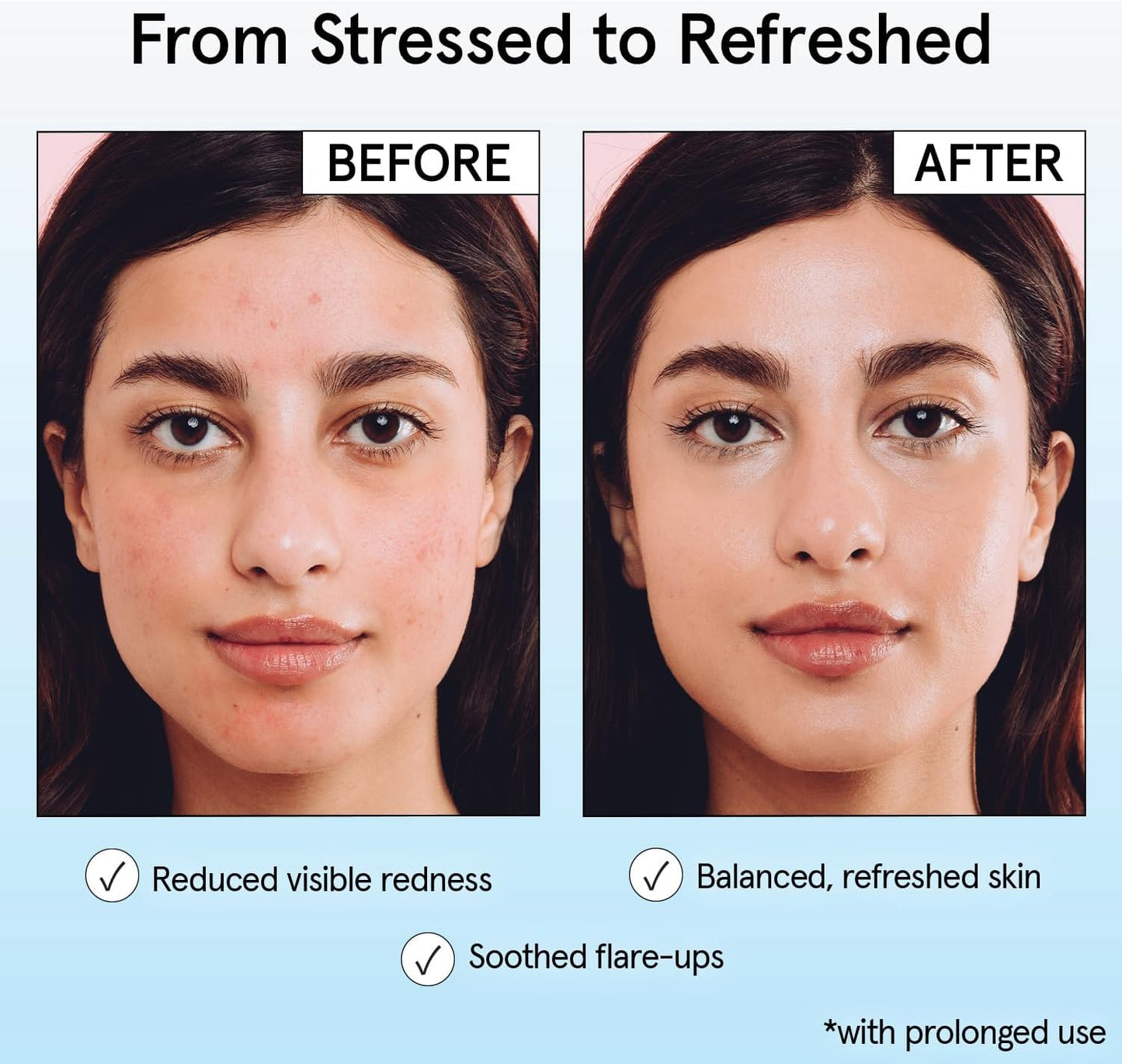 grace & stella Hypochlorous Acid Spray for Face - Body Acne Spray - Gentle Face Mist to Calm Redness & Flare-Ups Back Acne - Soothing Facial Mist Beauty and Personal Care grace & stella