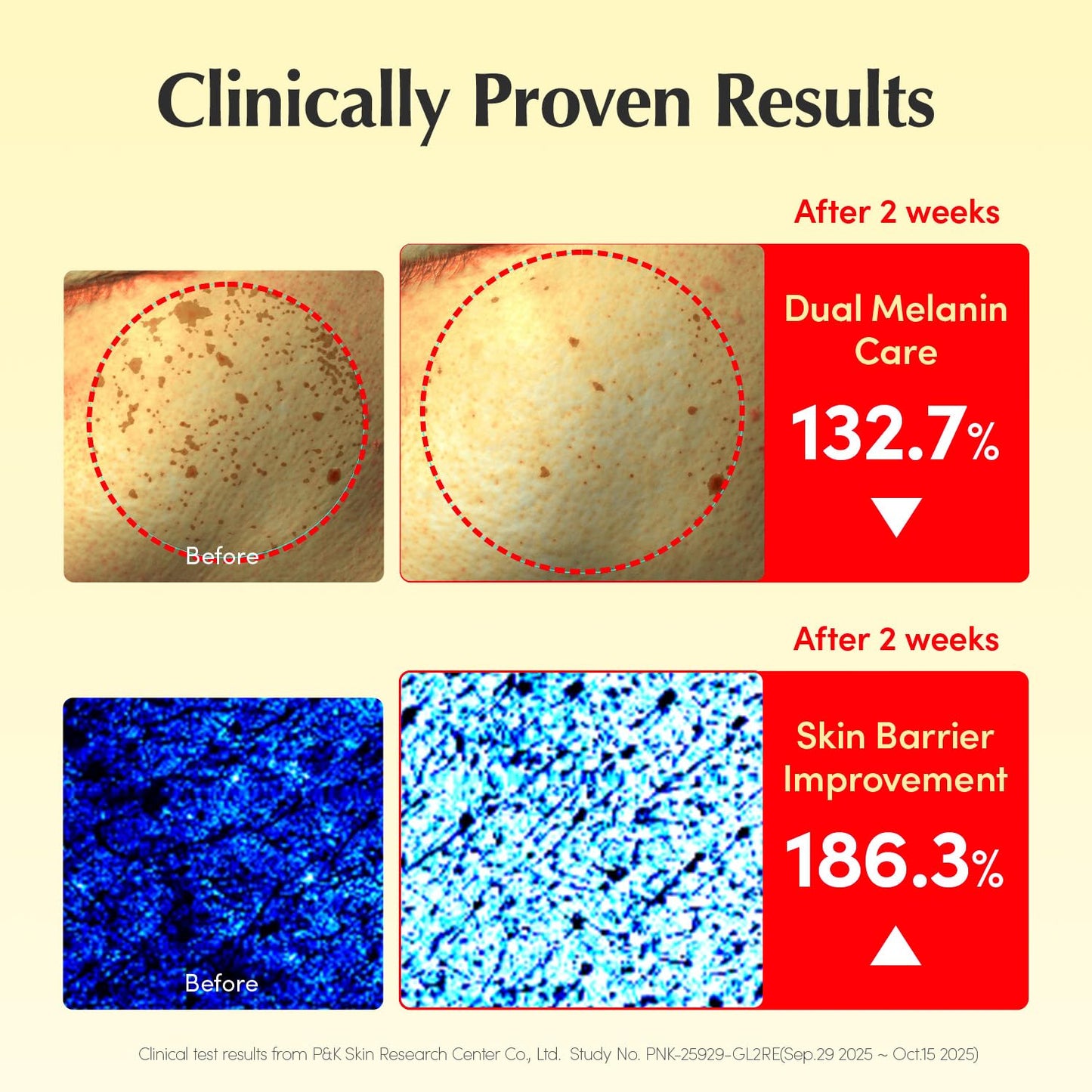EQQUALBERRY Vitamin Illuminating Cream | Vitamin C & 5% Niacinamide+3% TXA | Dark Spots & Ceramide Barrier Strength Face Moisturizer | Glowy Beauty and Personal Care EQQUALBERRY
