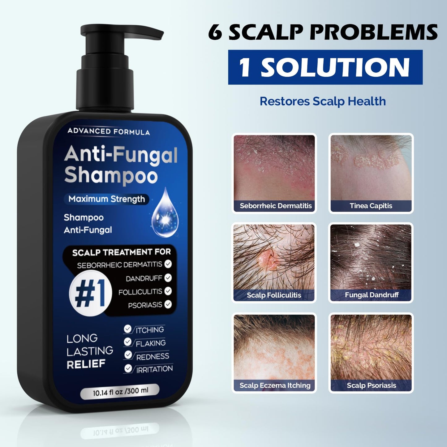 oely Antifungal Shampoo for Seborrheic Dermatitis, Folliculitis & Scalp Psoriasis, Anti-Dandruff Shampoo for Men & Women, Relieves Scalp Itching Beauty and Personal Care oely