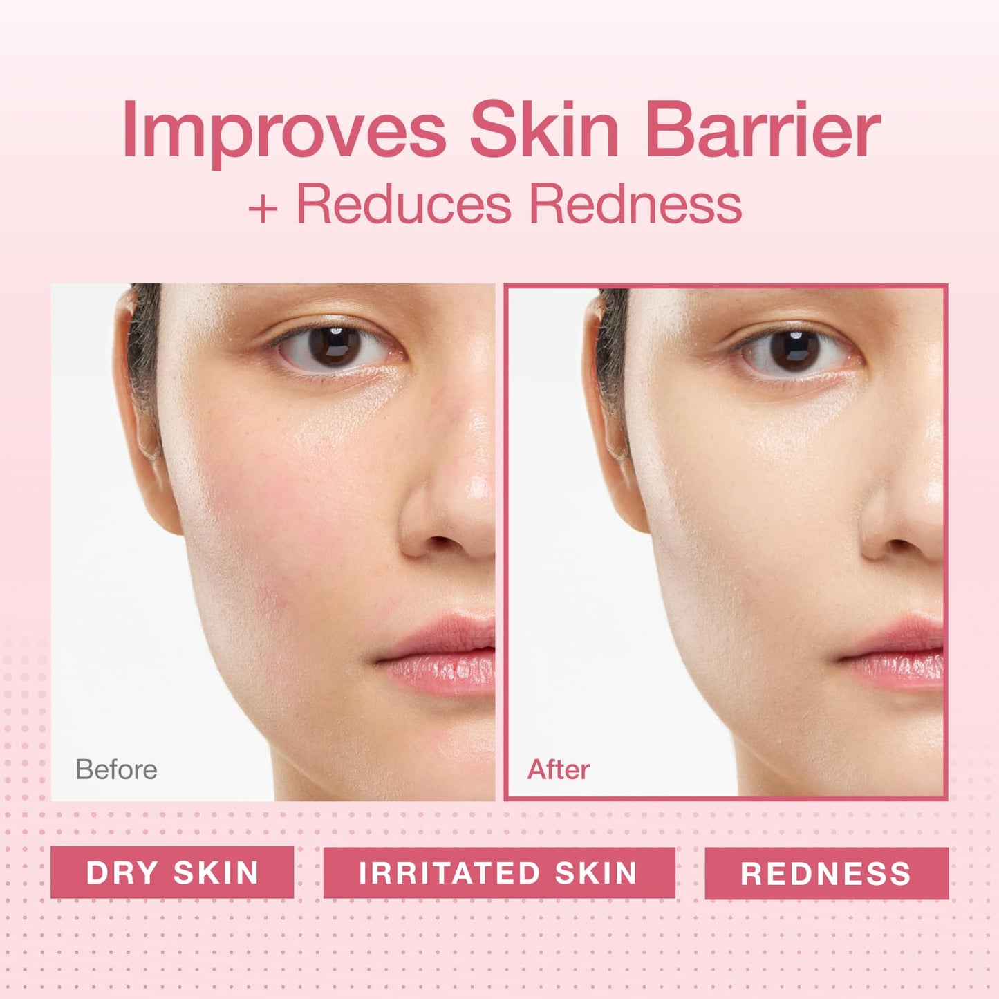 Physiogel Redness Reducing Cream - Ceramide Moisturizer for Dry, Sensitive & Redness-Prone Skin, Repairs Skin Barrier, Dermatologist-Tested Beauty & Personal Care PHYSIOGEL