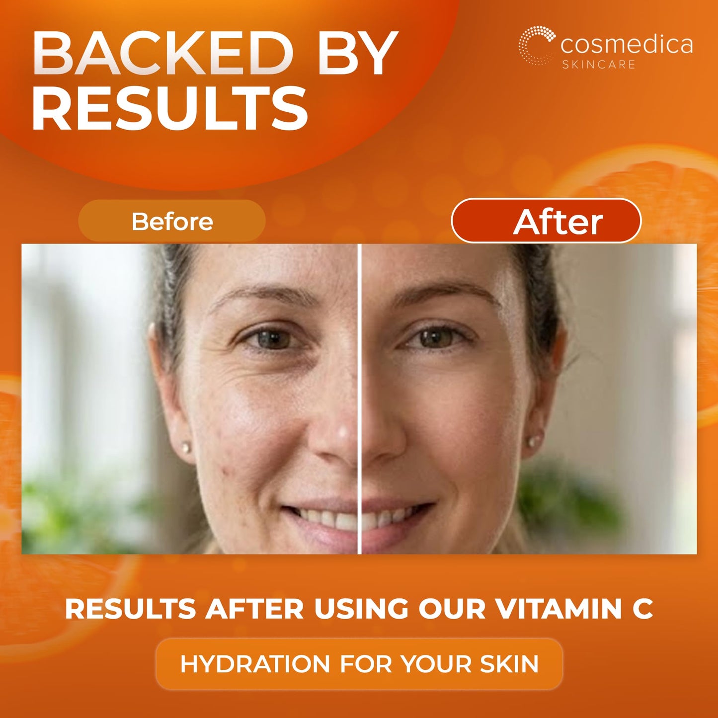 Cosmedica Vitamin C Serum for Face with Hyaluronic Acid & Vitamin E - Brightening Anti-Aging Serum for Dark Spots, Fine Lines & Wrinkles, Lightweight Beauty & Personal Care Cosmedica Skincare