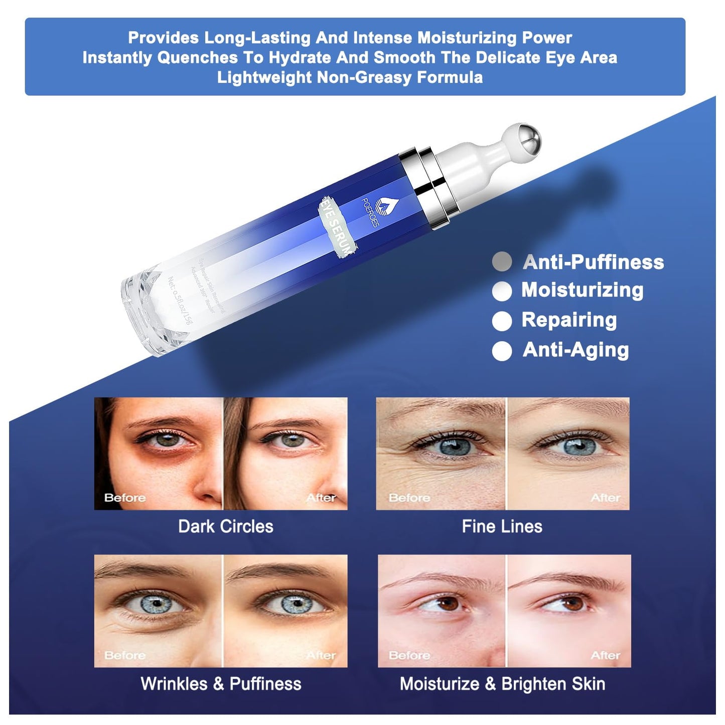 Eye Serum with 8% Caffeine 8% Retinol Hyaluronic Acid Niacinamide peptides for Puffy Bags Fine Lines Dark Circles Wrinkles, Under Eye Cream with 360° Beauty & Personal Care POEROES