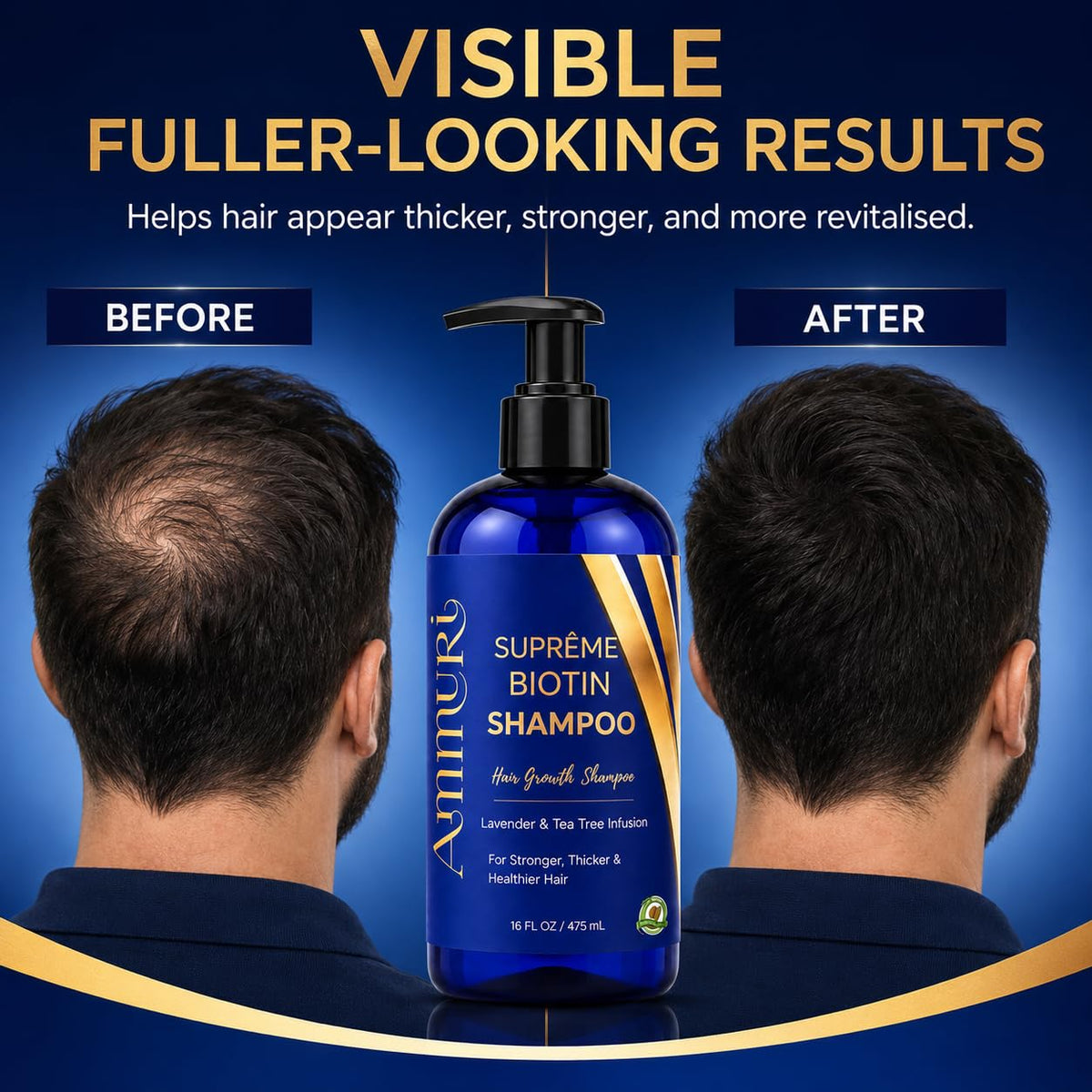 Ammuri Biotin Shampoo For Hair Loss - Natural Hair Loss Shampoo Enriched With Biotin & DHT Blocker Shampoo - Anti Dandruff Male & Female Hair Loss
