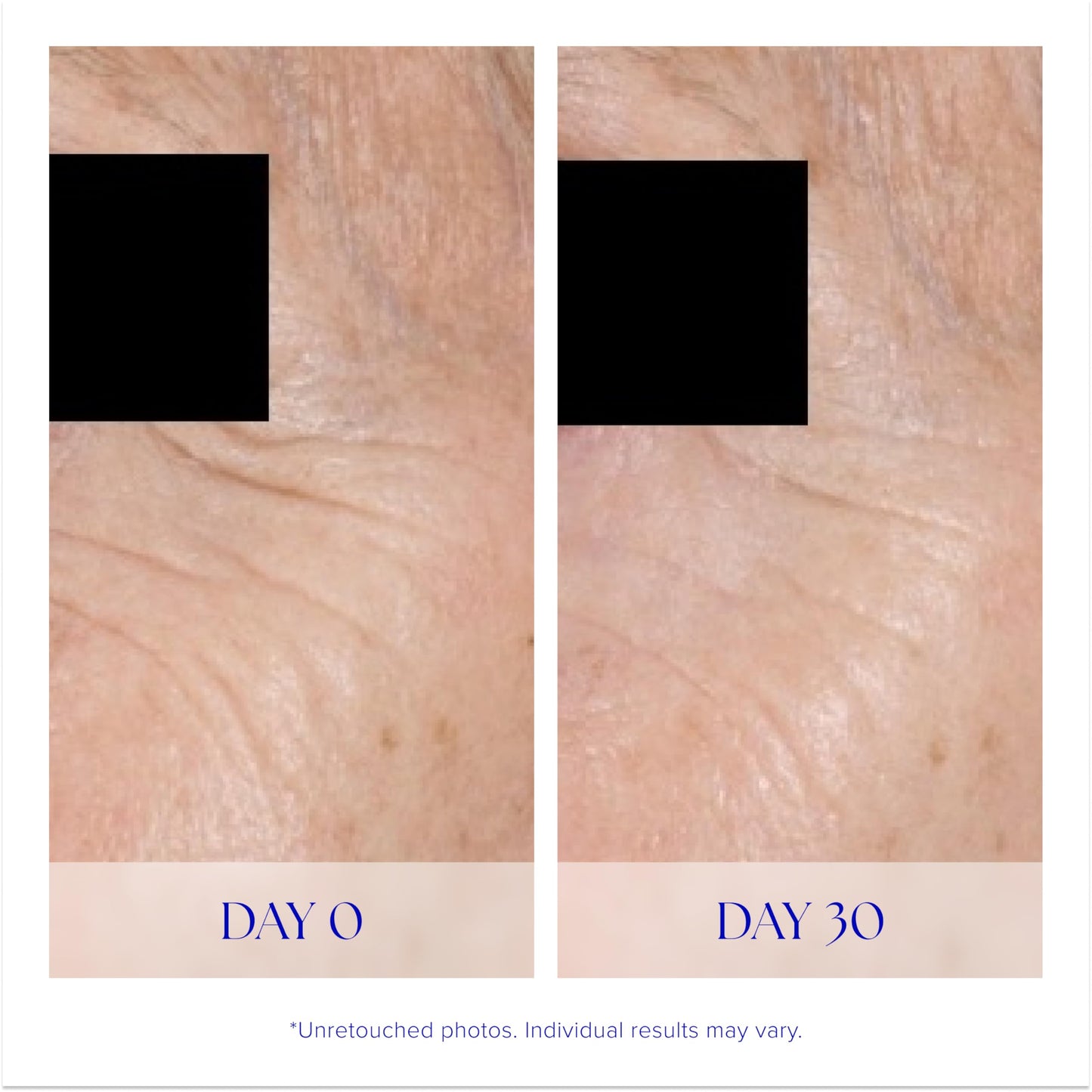 iS CLINICAL Youth Eye Complex, Anti-Aging Brightening Under Eye Cream, Reduces Puffiness, Hydrating and Firming Eye Cream Beauty & Personal Care iS CLINICAL