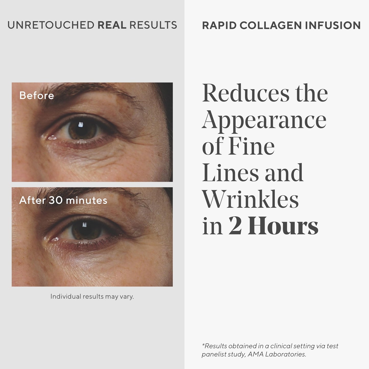 Murad Rapid Collagen Infusion - Anti-Aging Serum with Collagen Amino Acids & Winged Kelp Extract for Visible Wrinkle Reduction, Enhanced Skin Firmness Beauty & Personal Care Murad