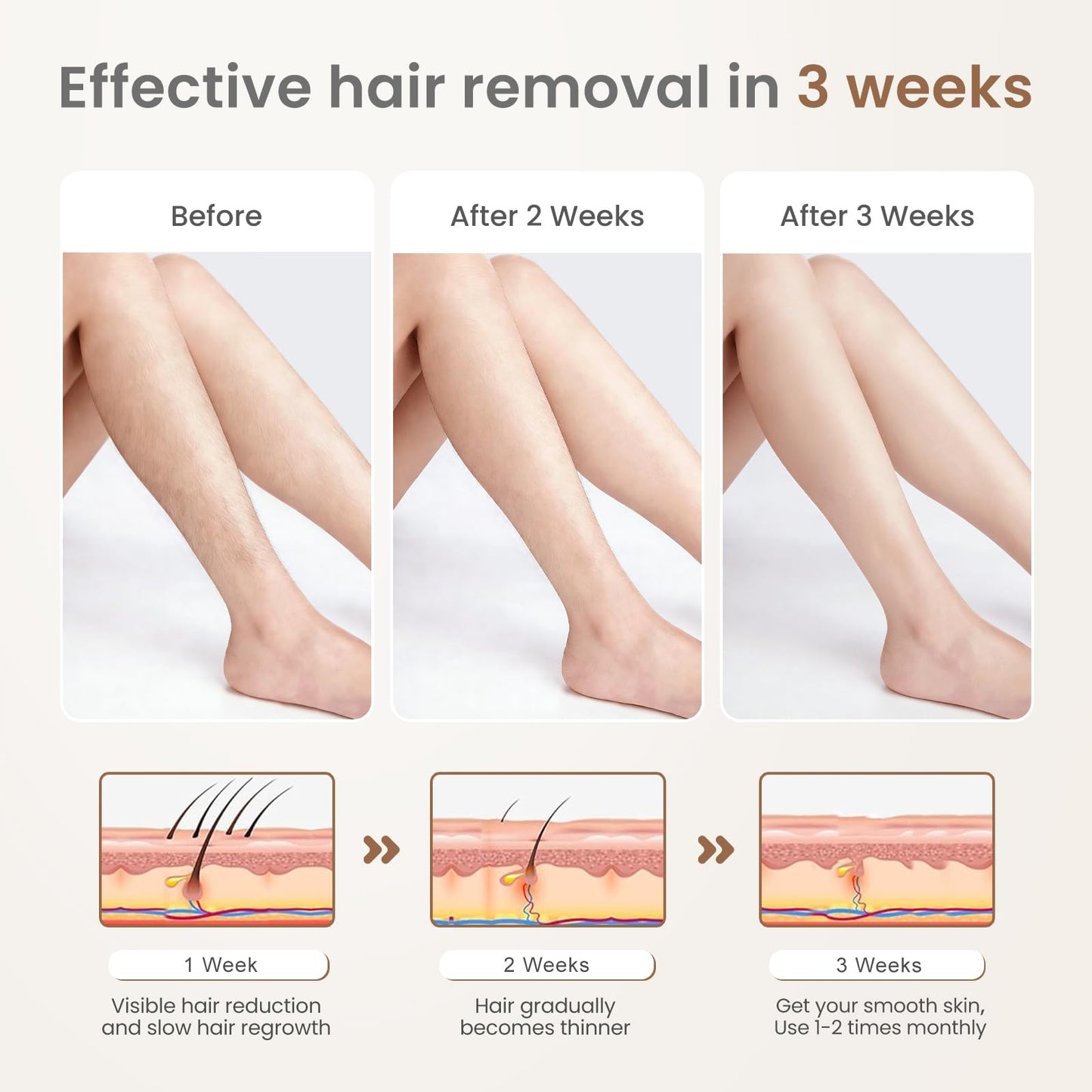 FELOOW IPL Laser Hair Removal: IPL Laser Hair Removal for Women, Long-Lasting Results,999,999 Flashes Hair Removal at Home, Model S3 Beauty and Personal Care FELOOW