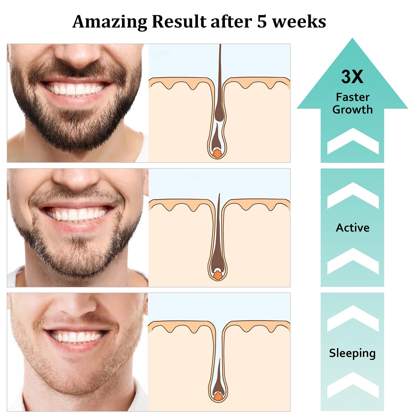 RAFFIN Beard Growth Kit, Beard Growth Oil (2Oz) w/3 X Thickening Biotin & Castor Oil for Spot/Patchy Beard, Achieve Fuller, Thicker, Healthier Beard Beauty and Personal Care RAFFIN