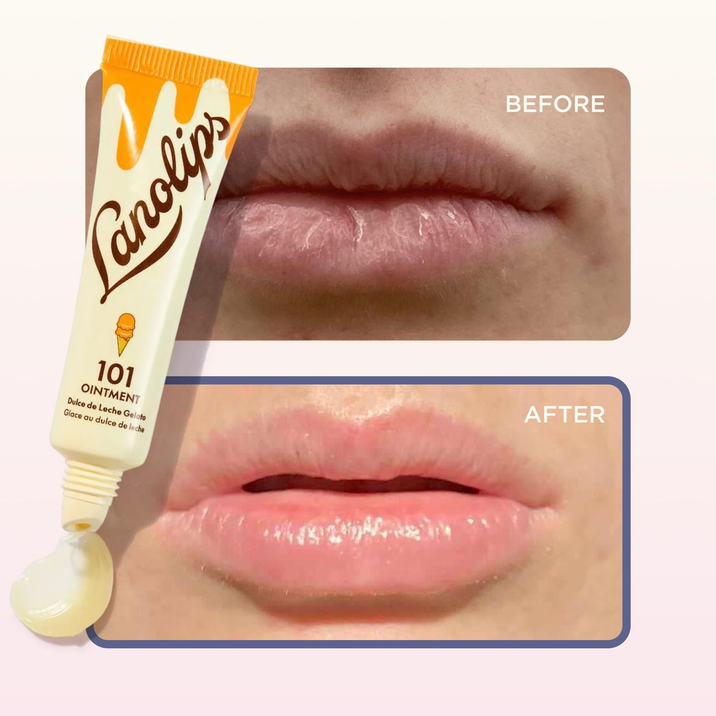 Lanolin 101 Multipurpose Ointment - Lanolin Lip Balm & Healing Ointment for Skin Barrier Repair - Moisturizer for Dry Lips, Cuticles & Elbows - No Beauty and Personal Care Lanolips