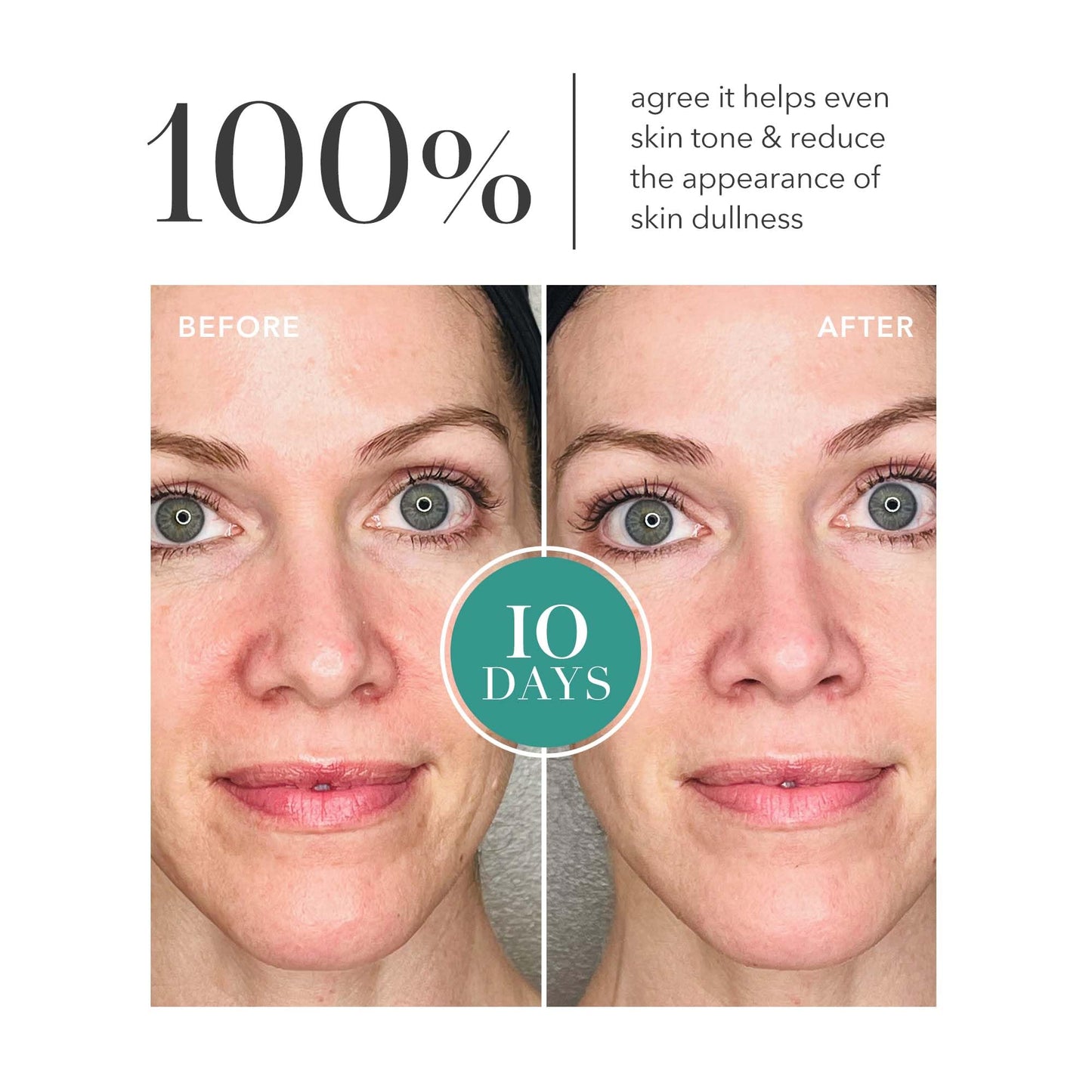 Algenist GENIUS Liquid Collagen Essence - Lightweight Hydrating Face Essence with Alguronic Acid & Vegan Collagen - Helps Improve Elasticity Beauty & Personal Care Algenist