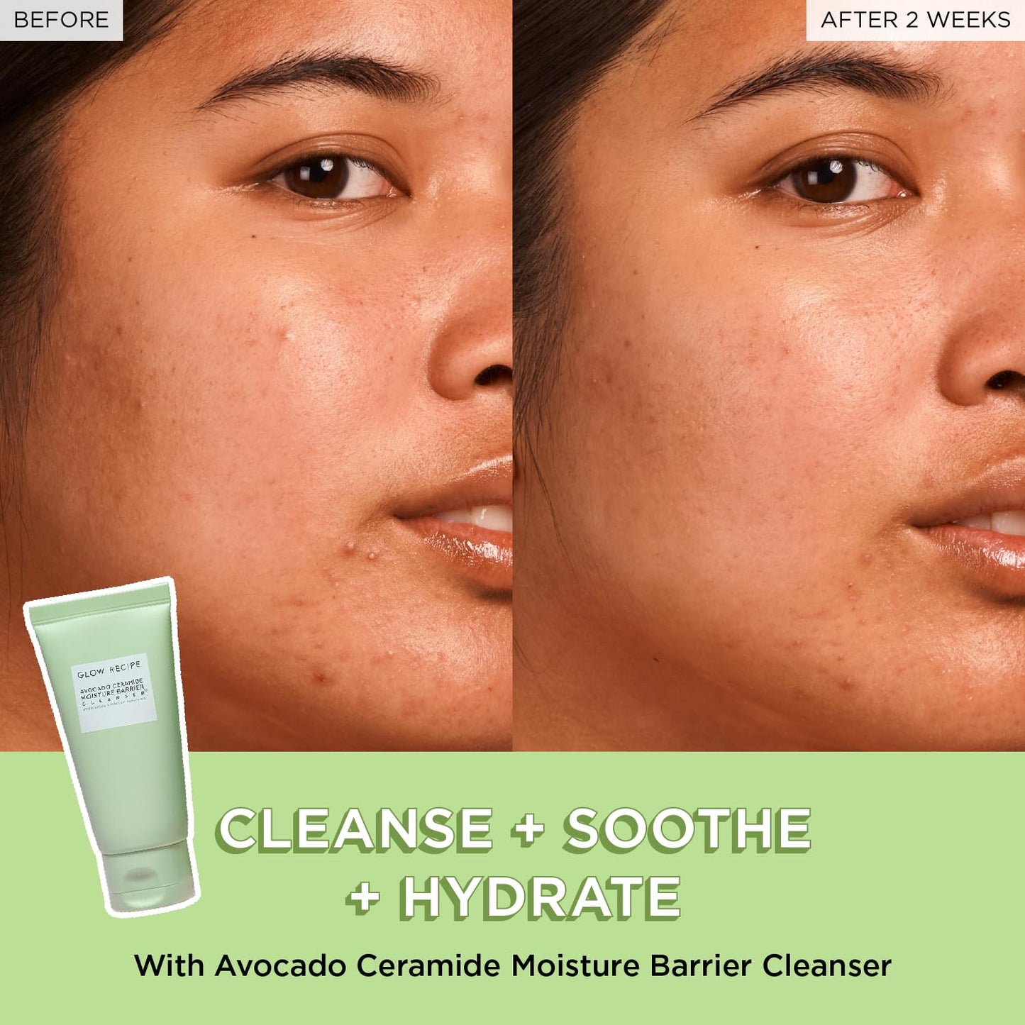 Glow Recipe Avocado Ceramide Facial Cleanser, Korean Double Cleanse Second Step, Hydrating Gel-to-Foam Face Wash for Dry Skin, Barrier Support Beauty & Personal Care Glow Recipe