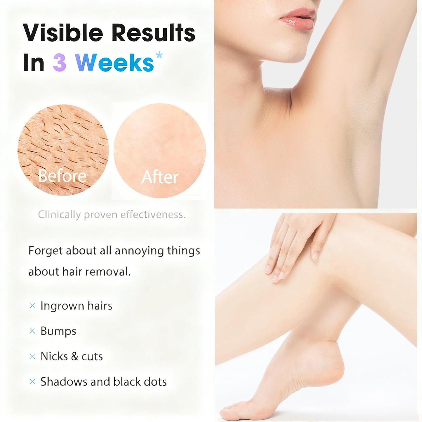 IPL Laser Hair Removal Device for Women & Men - At-Home Painless Ultra-Fast Flash Hair Remover, 86% Hair Reduction in 4 Weeks, High Energy & 5 Modes Beauty and Personal Care Gransumr
