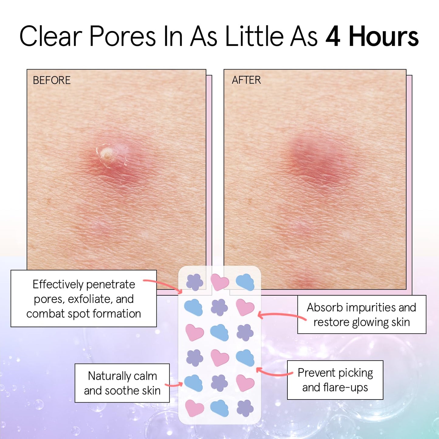 grace & stella Award Winning Pore Strip - Pimple Patches for Face - Hydrocolloid Acne Patches - Absorbs Zits, Reduces Redness - Cute Patches Beauty & Personal Care grace & stella