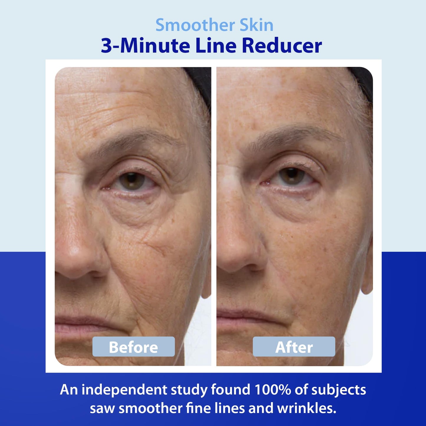Dr. Denese Wrinkle Lost Line Reducer 1 oz - Hydrating Serum with Silk Protein Fiber Technology for a Smoother Appearance - Lightweight Daily Formula Beauty & Personal Care Dr. Denese