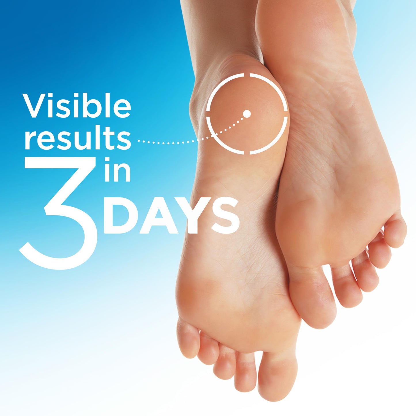 Flexitol Heel Magic For Dry Skin or Rough Heels with Shea Butter & Vitamin E, 2.5 Ounce Beauty & Personal Care Flexitol