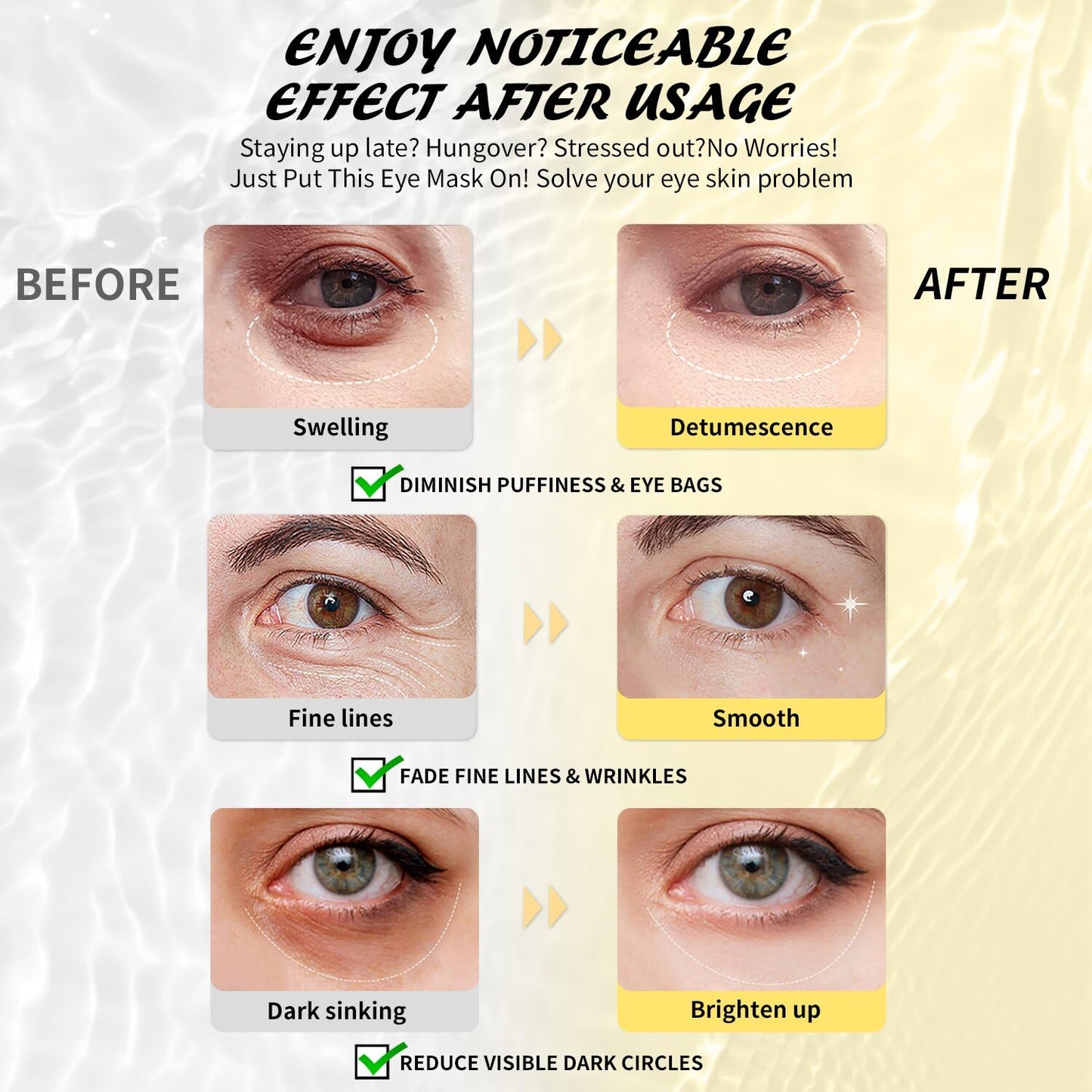 Maskiss Under Eye Patches (25 Pairs), Hyaluronic Acid Eye Masks for Dark Circles Puffy Eyes Undereye Bags, Collagen Eye Patches for Wrinkles Beauty & Personal Care Maskiss