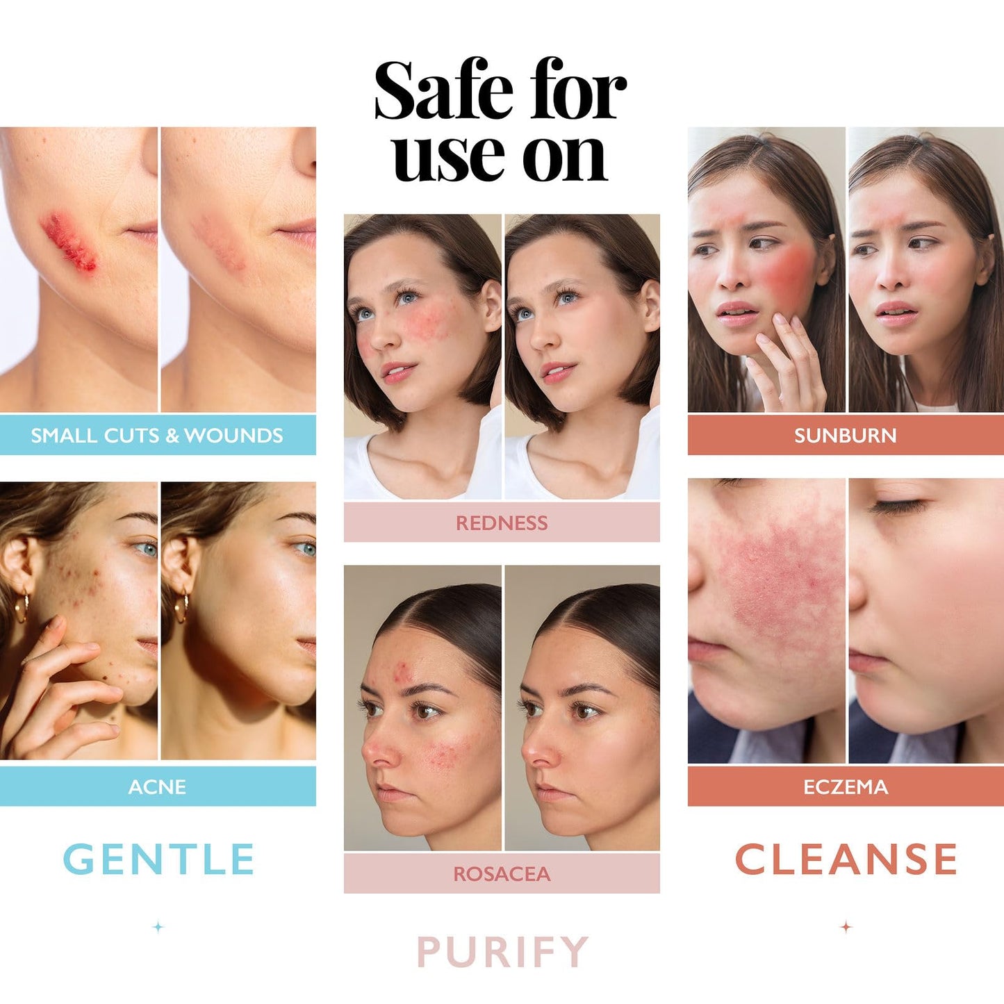 Hypochlorous Acid Spray for Face and Skin; Facial Cleanser | 8oz Face Mist Hypochlorous Acid Spray for Skin, Acne, Rash, Eczema, Wound | Antimicrobial Beauty and Personal Care Aquia