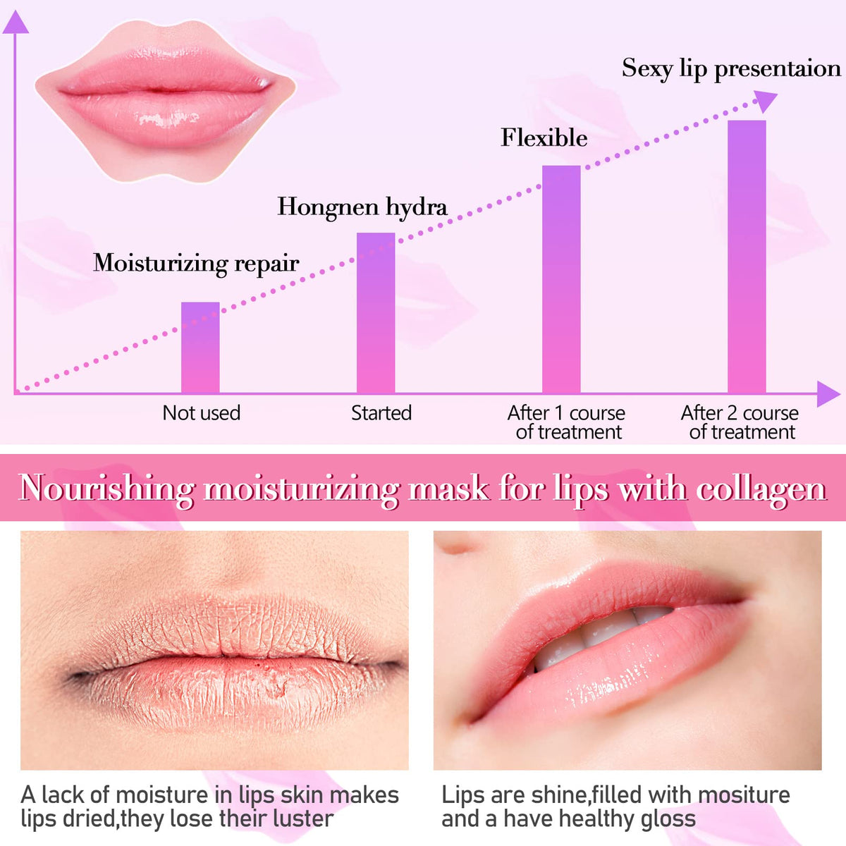 Kipeber 50PCS Lip Mask Sheet,Collagen Crystal Lip Masks,Pink Lip Care Pads Mask for Moisturizing Nourishing,Anti-Aging & Anti-Wrinkle,Lip Gel Patches Beauty & Personal Care Kipeber