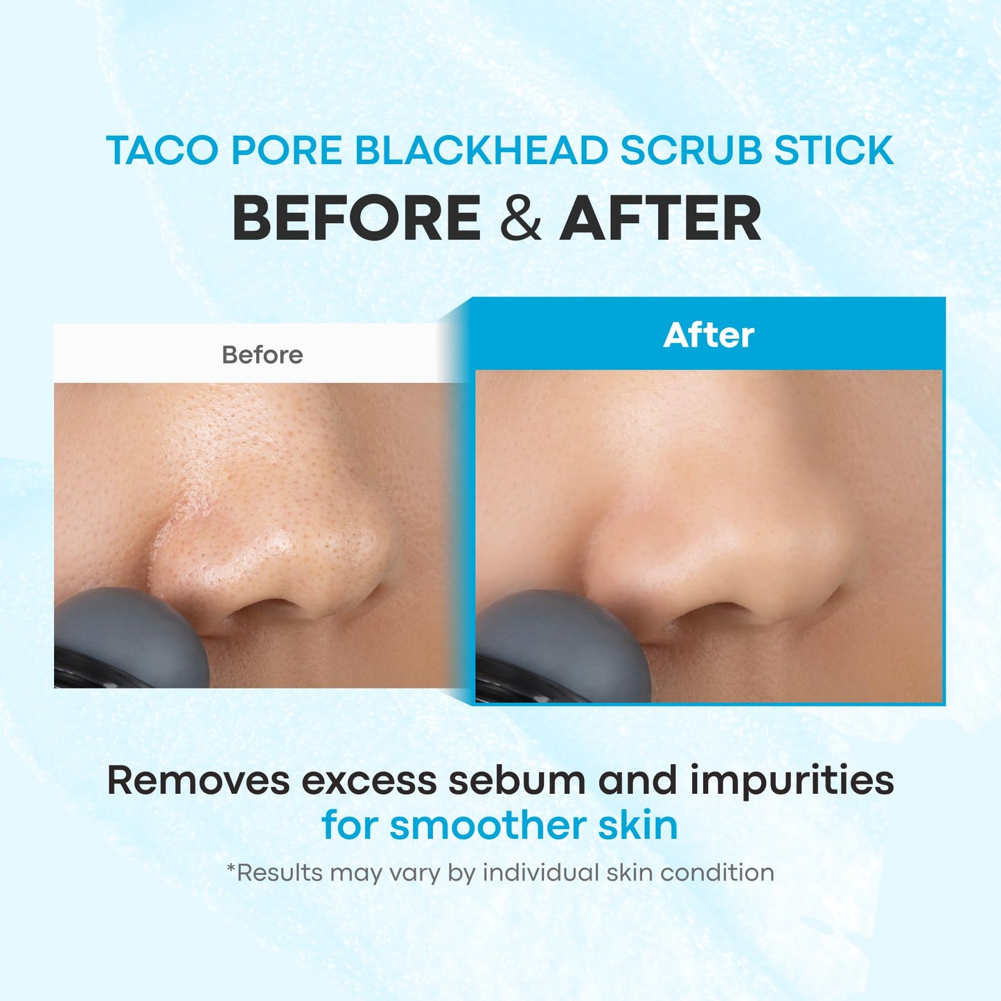 TONYMOLY Tako Pore Blackhead Remover Scrub Stick Charcoal & Dead Sea Salt Exfoliator for Blackheads, Whiteheads, Pore Cleansing & Oil Control, 0.8 oz Beauty and Personal Care TONYMOLY