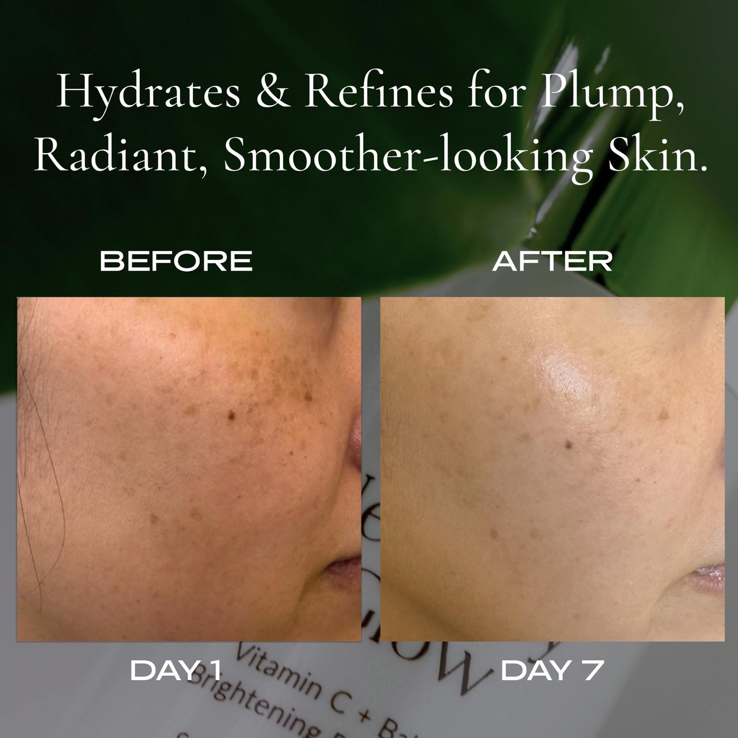 Korean Bakuchiol Serum + Niacinamide & Vitamin C | Plumping | Retinol Alternative | Firming | Brightening | Fine Lines | Uneven Tone (WYLYS) Beauty & Personal Care WYLYS