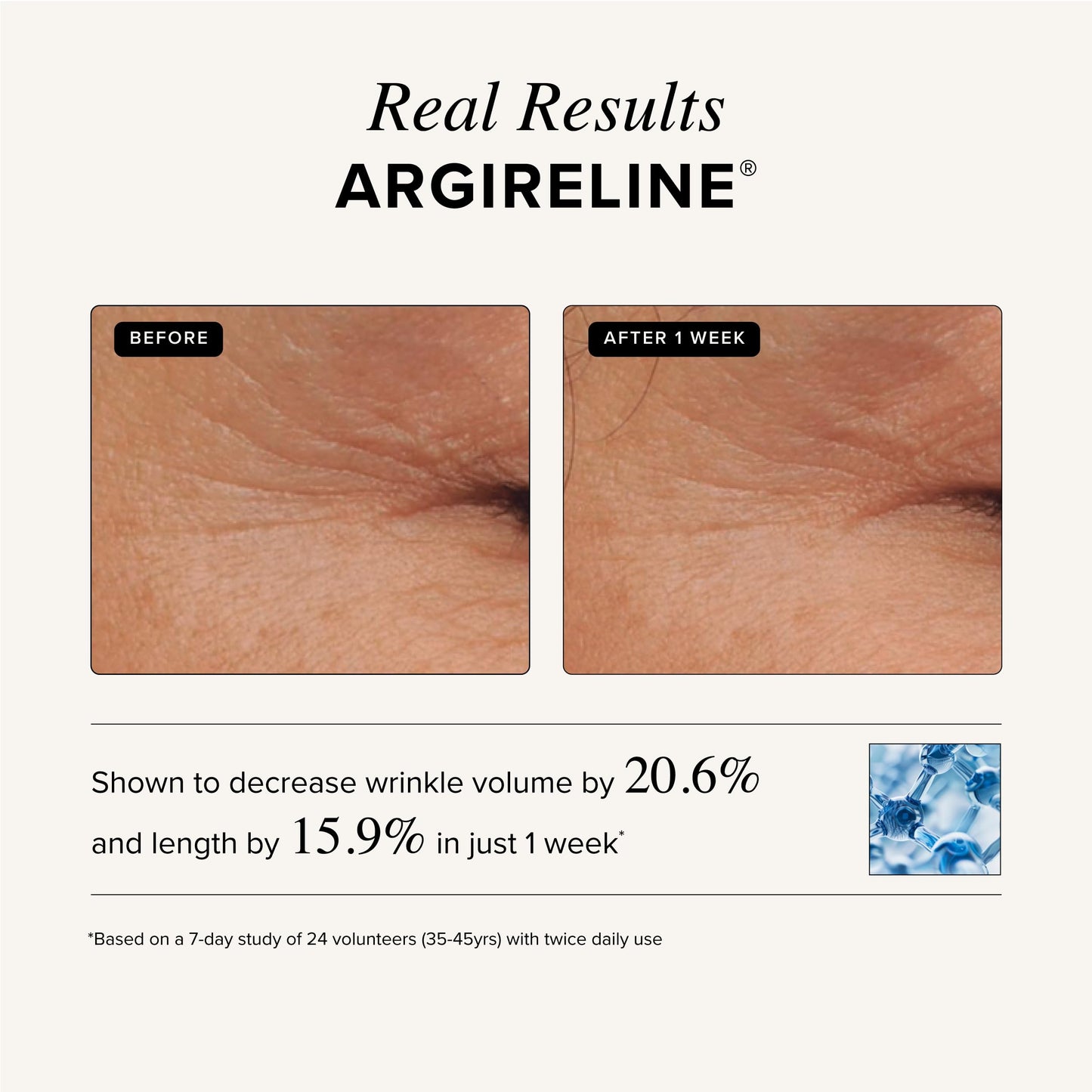 Asterwood Triple Repair Matrixyl 3000 + Argireline + Hyaluronic Acid + Vitamin C Serum for Face - Anti-Aging, Collagen Boosting, Hydrating Beauty & Personal Care Asterwood