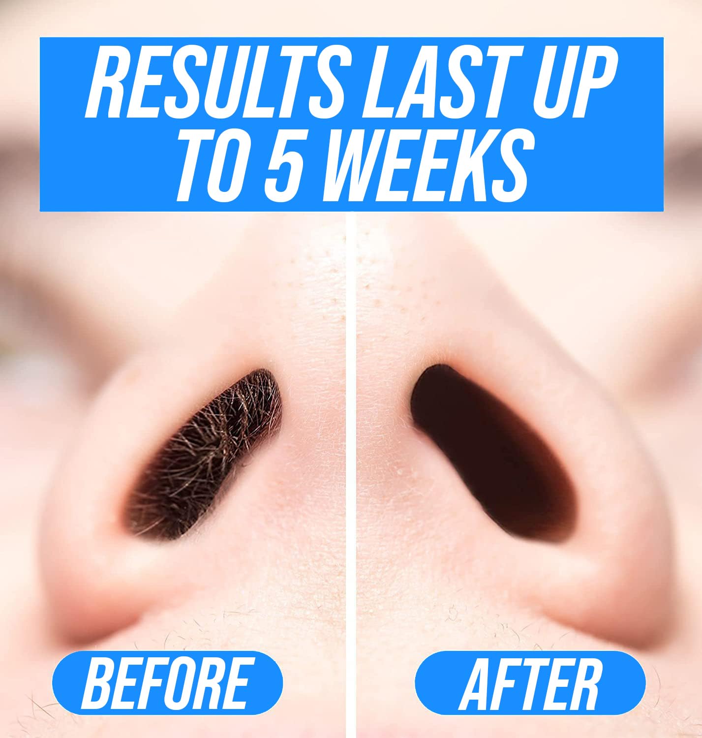 KENASHII Nose Wax Kit | 100 g Wax, 24 Applicators | The Original & Best Nose and Ear Hair Removal Kit from Kenashii | Nasal Waxing For Men and Women | Beauty and Personal Care KENASHII