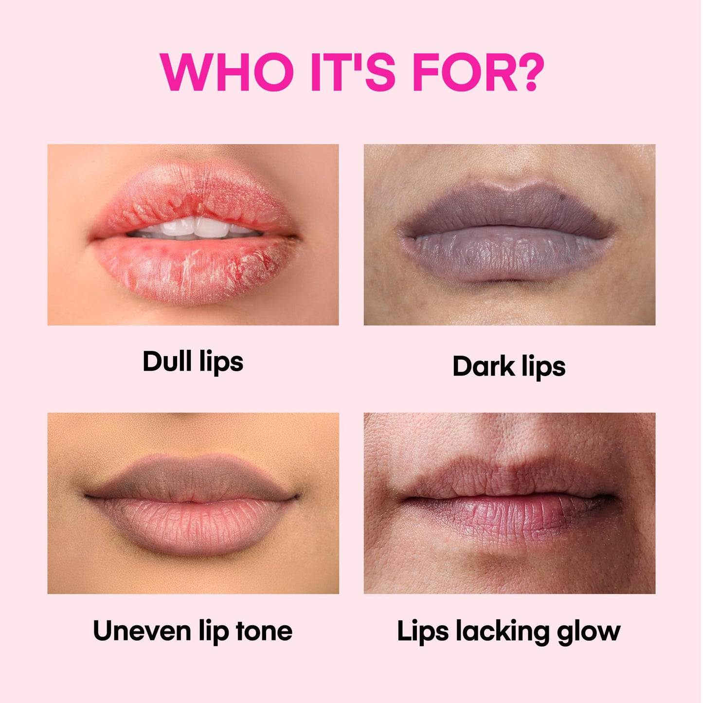 KissBea Lip Lightening for Dark Lips: for Smokers, Dry or Uneven-Toned Lips - Restores Natural Look & Moisture with VC, Lemon Peel & Licorice Beauty and Personal Care Kissbea