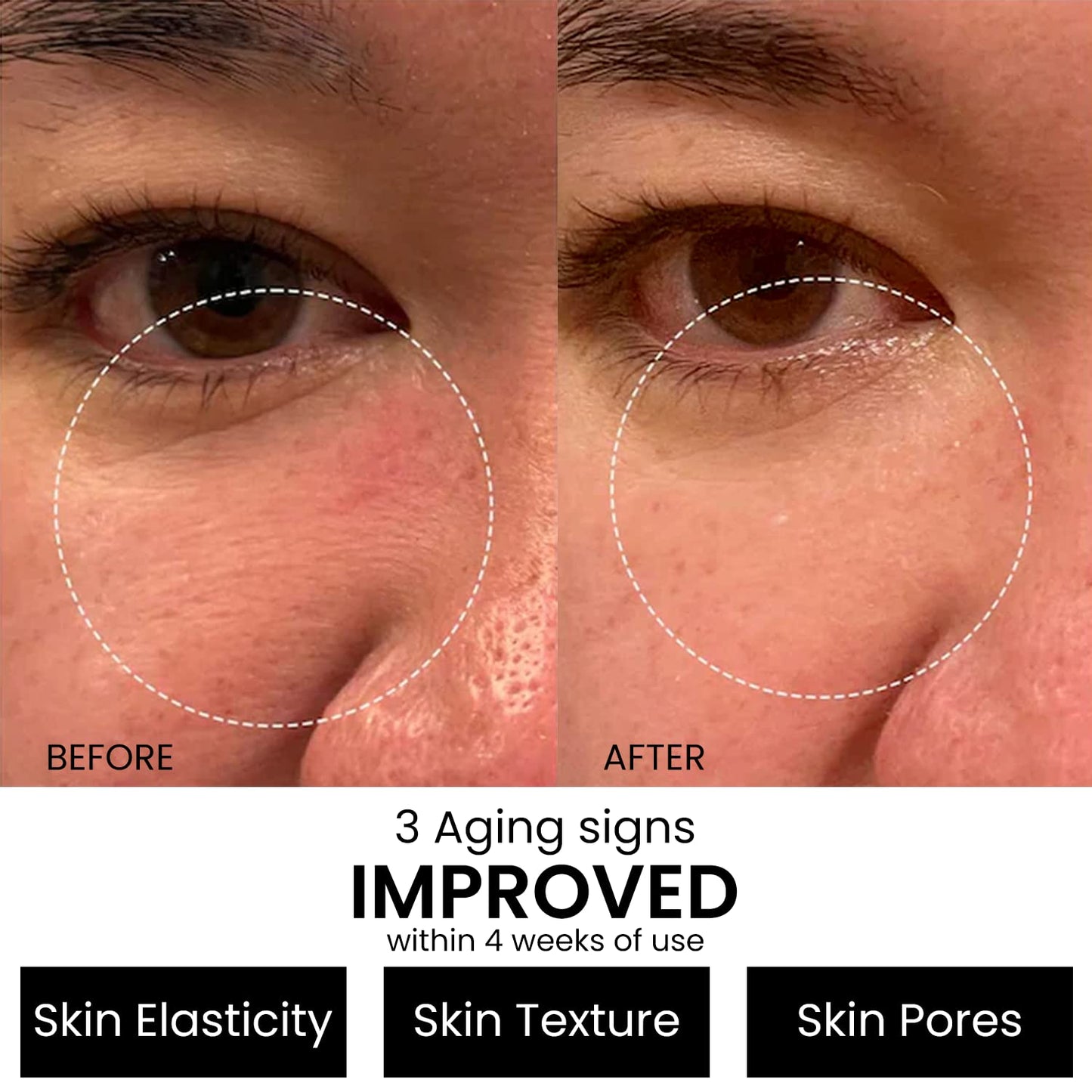 Kleem Retinol Serum 2.5% for Face Anti-Aging Serum with Hyaluronic Acid to Minimize Wrinkles. Improves Sun Damaged Skin and Fades Dark Spots - Vitamin Beauty & Personal Care Kleem Organics