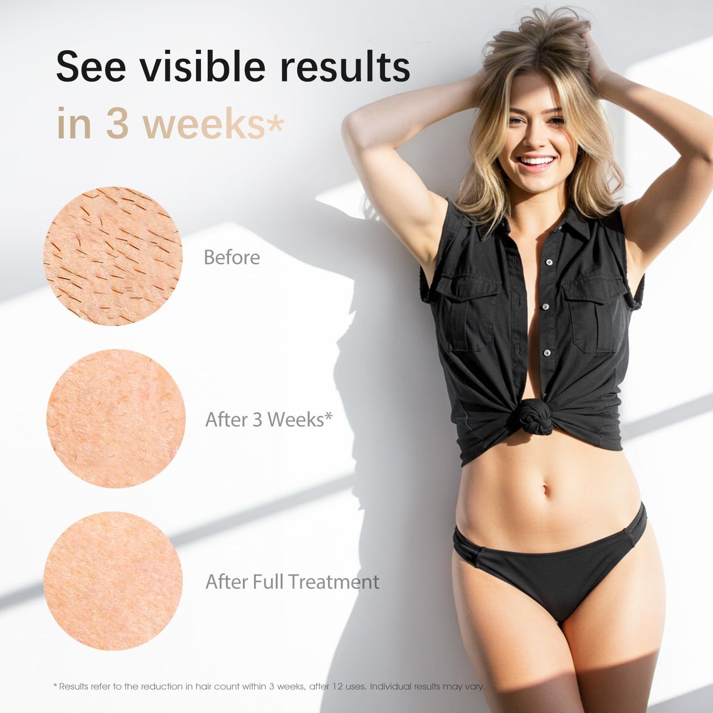 IPL Laser Hair Removal Device for Women & Men - Safe At-Home 45°F Ice-Cooling Contact for Painless & Long-Lasting Results, 86% Less Hair In 3 Weeks Beauty and Personal Care AMOTAOS