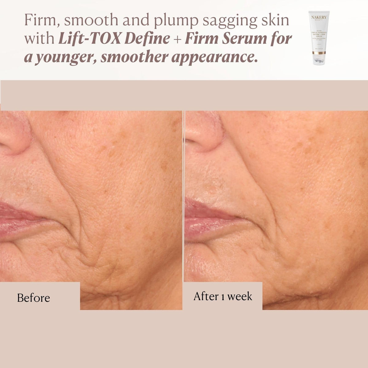 Nakery Lift-Tox Define & Firm Face Tightening Treatment with NAD+ & Collagen Booster, Neck & Jawline Roller for Sagging Skin, Lifting Wrinkles, Jowls