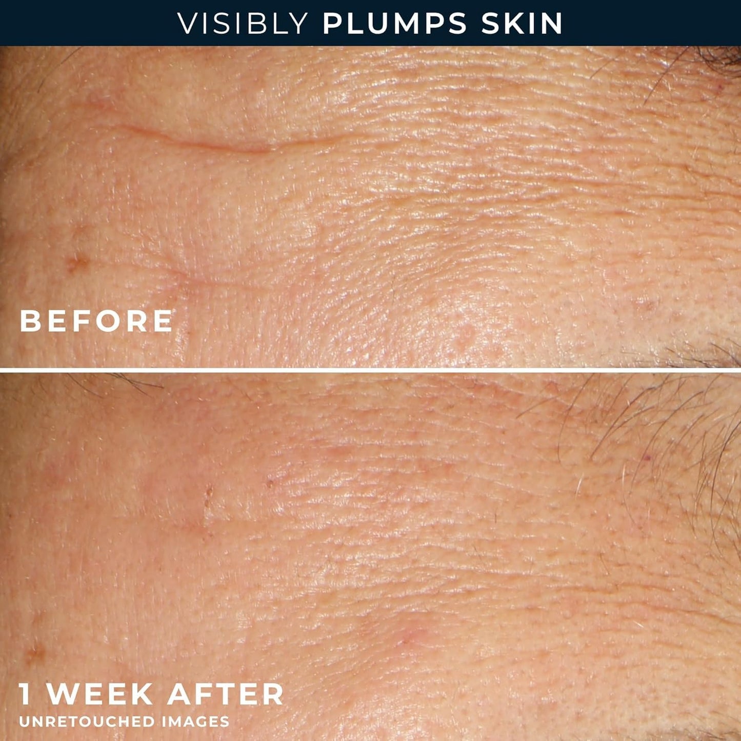 RoC Multi Correxion Hyaluronic Acid Night Serum Capsules (30 CT) for Intense Hydration + RoC Retinol Capsules (7 CT), Anti-Aging Skin Care Wrinkle Beauty and Personal Care RoC