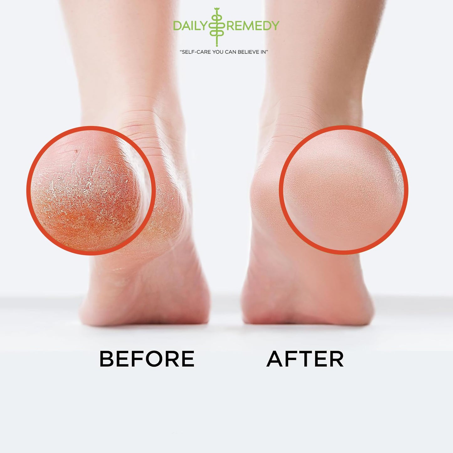 Muscle Relief Foot Soak with Epsom Salt, Made in USA, Soothe Tired Feet, Softens Calluses and Helps Athletes Foot 1lbs Beauty and Personal Care DAILY REMEDY
