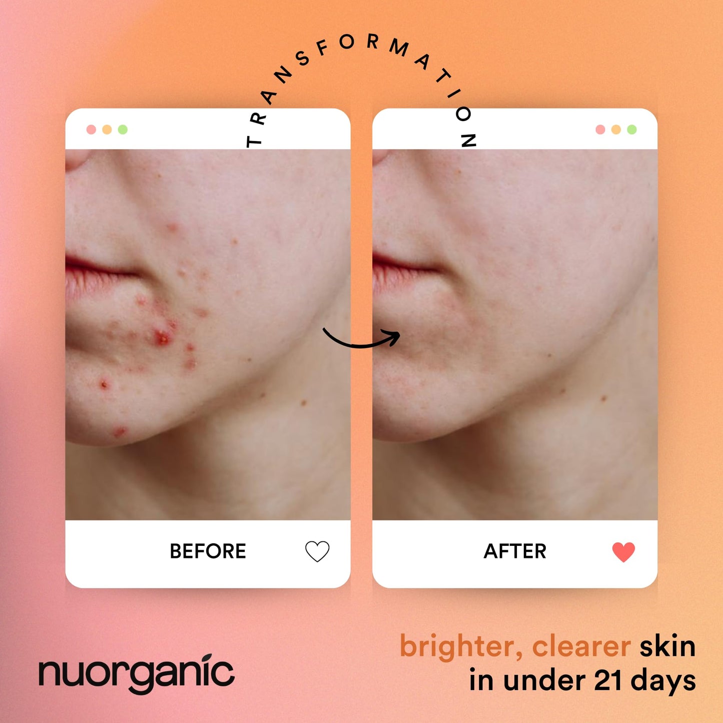 nuorganic Turmeric Face Mask - Soothing, Acne Clearing, Pore Refining, Exfoliating - New Airtight Squeezy Tube, Stays Fresh for 12 Months - Clean Beauty & Personal Care NuOrganic Cosmetics