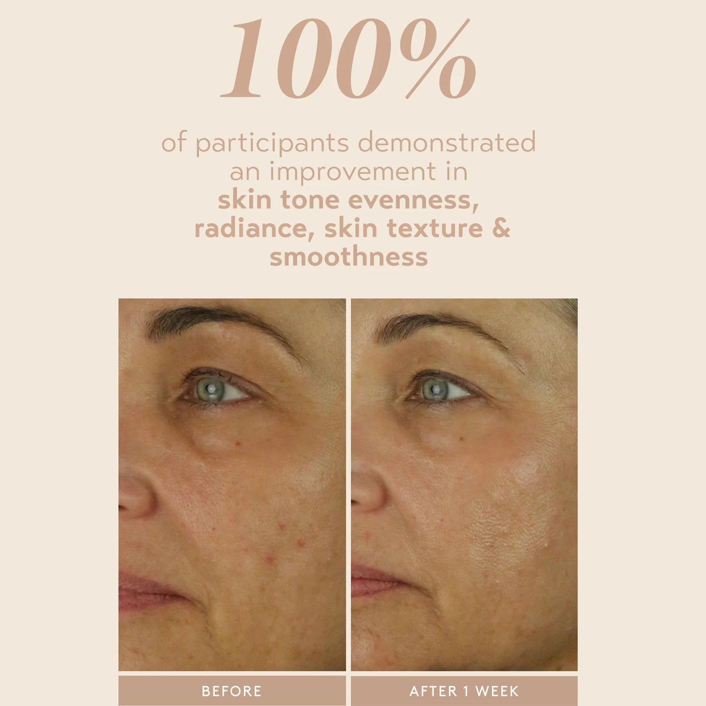 SHANI DARDEN SKIN CARE Retinol Reform with 1% Encapsulated Retinol Serum for Face & Neck, Gentle Slow-Release Face Serum with Tripeptide for Wrinkles Beauty & Personal Care SHANI DARDEN