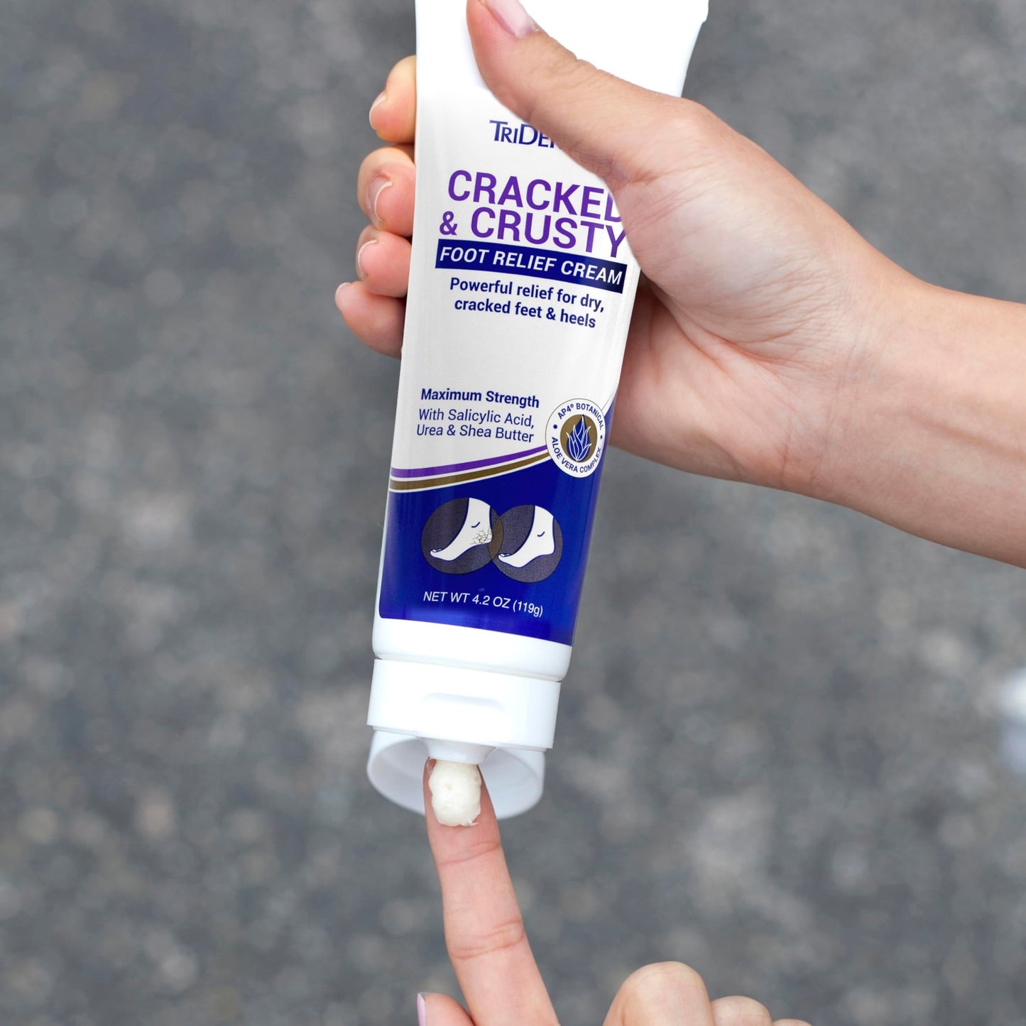 TriDerma Cracked & Crusty™ Healthy Foot Cream Moisturizes, Softens and Heals Dry Feet, Cracked Heels and Dry Elbows with Salicylic Acid, Urea, Shea Beauty & Personal Care TriDerma