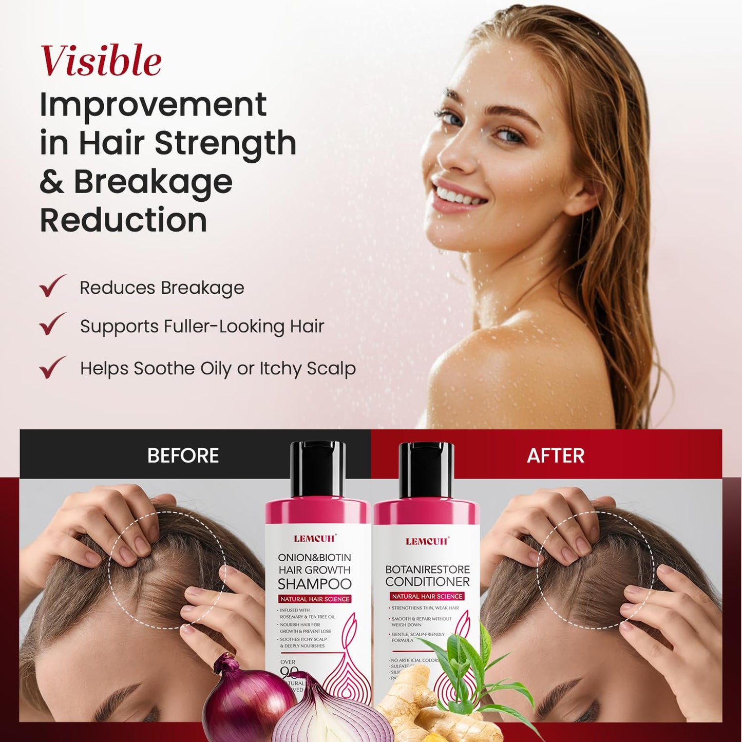 Onion Shampoo and Conditioner For Hair Growth - Onion Hydrosol Shampoo Duo With Biotin, Rosemary For Thinning and Healthier Thicker hair - Paraben Beauty & Personal Care Lemcuh