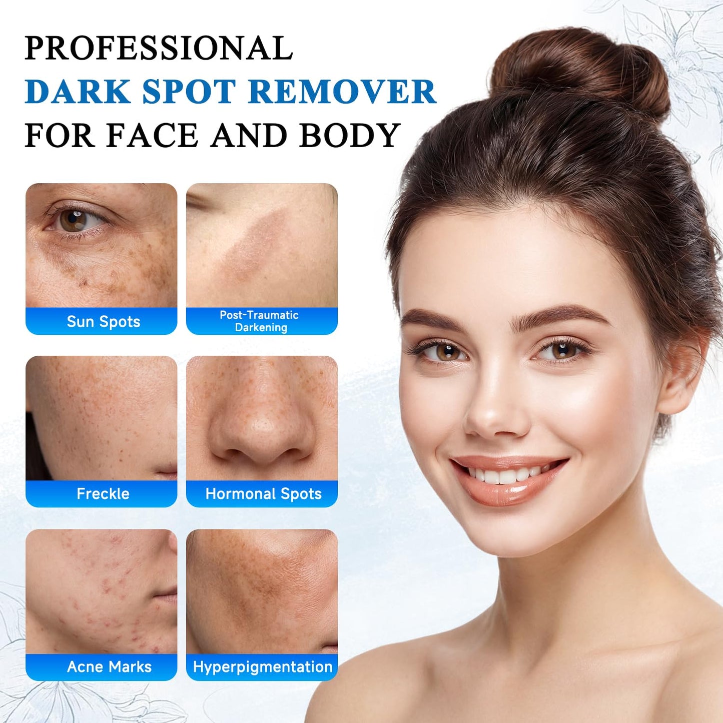 VBBV Dark Spot Remover for Face and Body, Dark Spot Corrector, Sun Spot Freckles Hyperpigmentation Treatment, Advanced Dark Spot Remover Cream Beauty & Personal Care VBBV