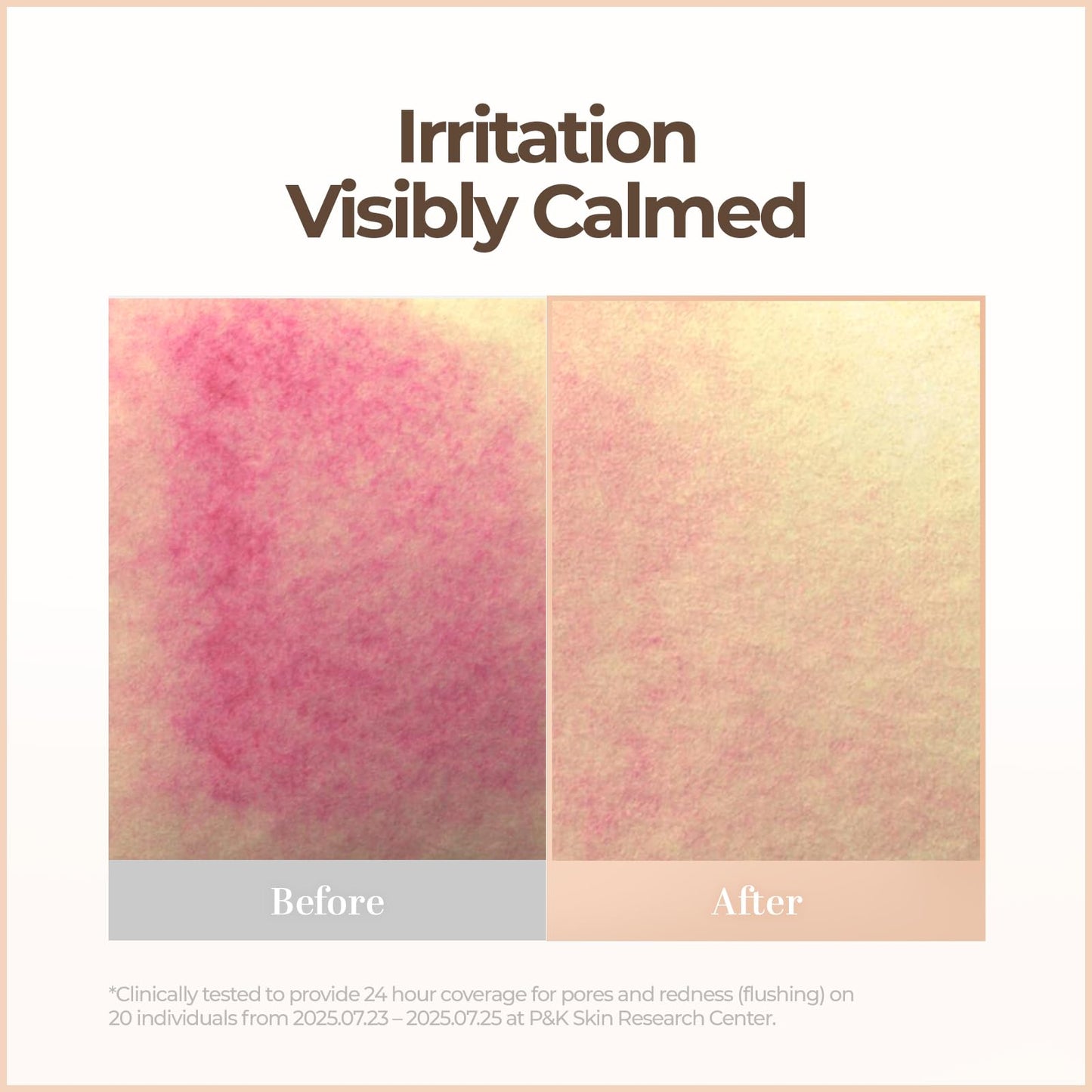 Cell Fusion C Skin Blemish Balm No.32 Mocha - Medium-Tan with Warm Undertone, Lightweight BB Cream with Ceramide, Tinted Moisturizer for Sensitive Beauty and Personal Care Cell Fusion C