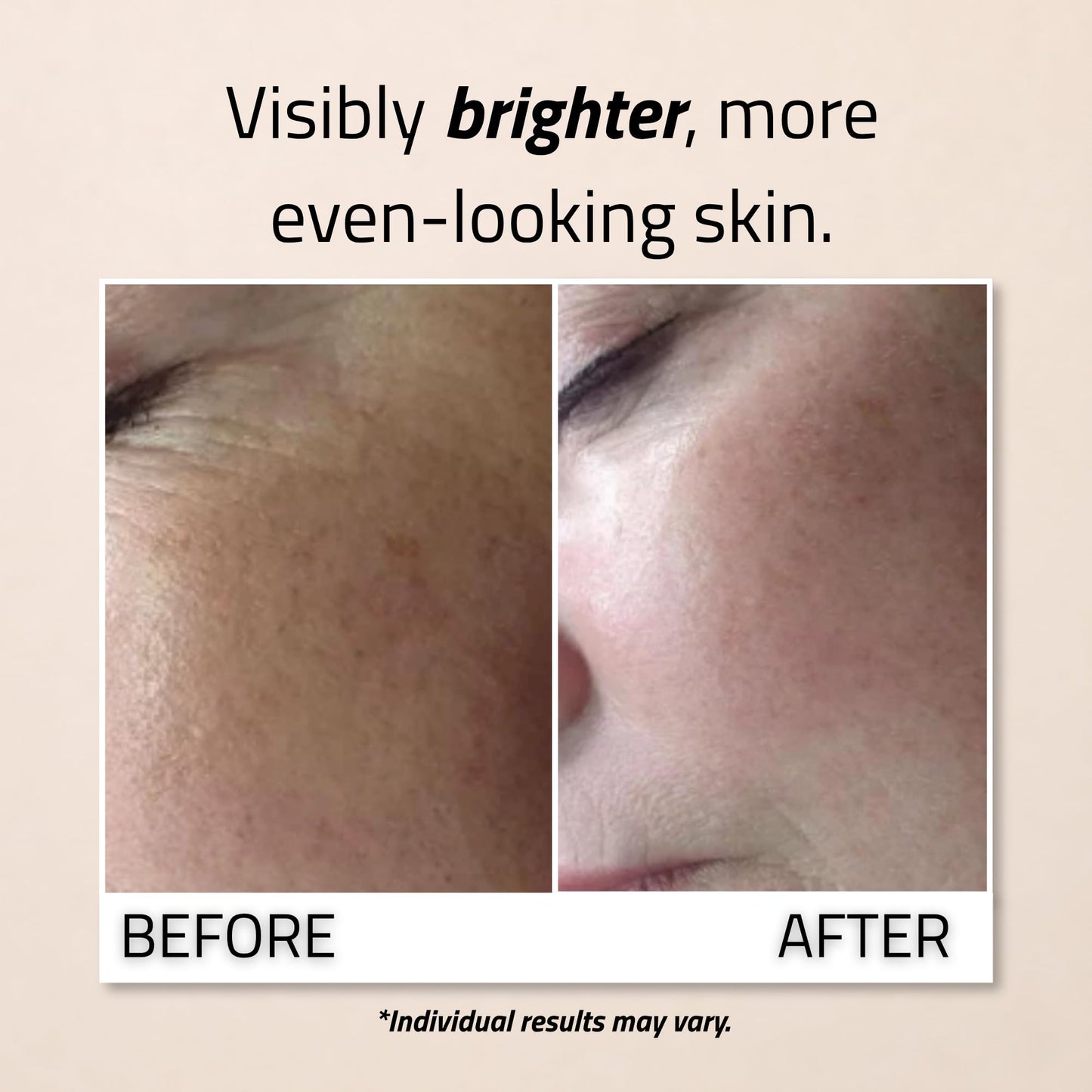 YEOUTH Vitamin C Serum for Face with Hyaluronic Acid and Vitamin E, Brightening Face Serum Targets the Appearance of Fine Lines and Uneven Skin Tone Beauty & Personal Care YEOUTH
