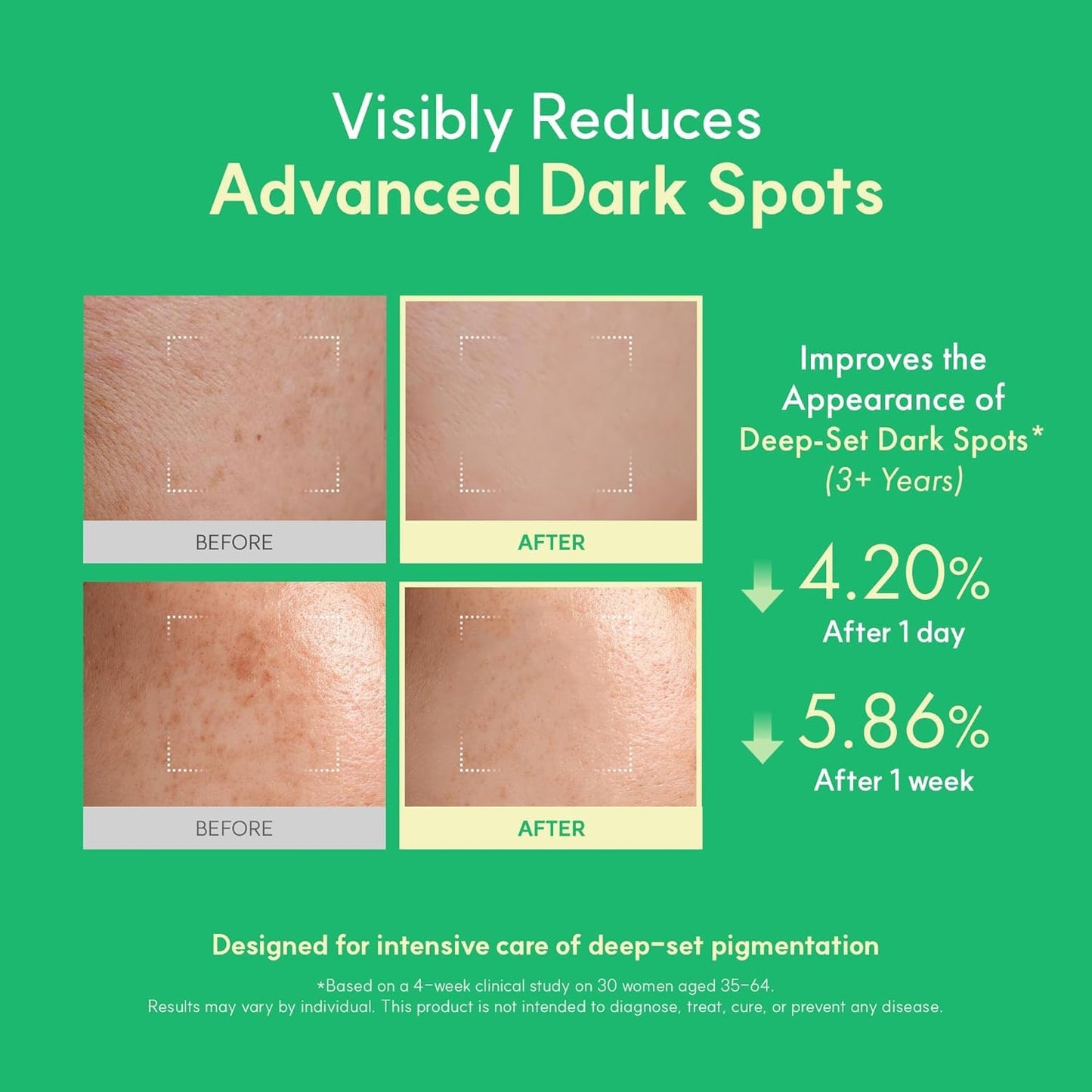 Easydew DW-EGF Melatoning Ampoule 5X - Hydrating Dark Spot Serum with Niacinamide & Glutathione for Uneven Skin - Fast Absorbing Day & Night Ampoule Beauty and Personal Care EASYDEW