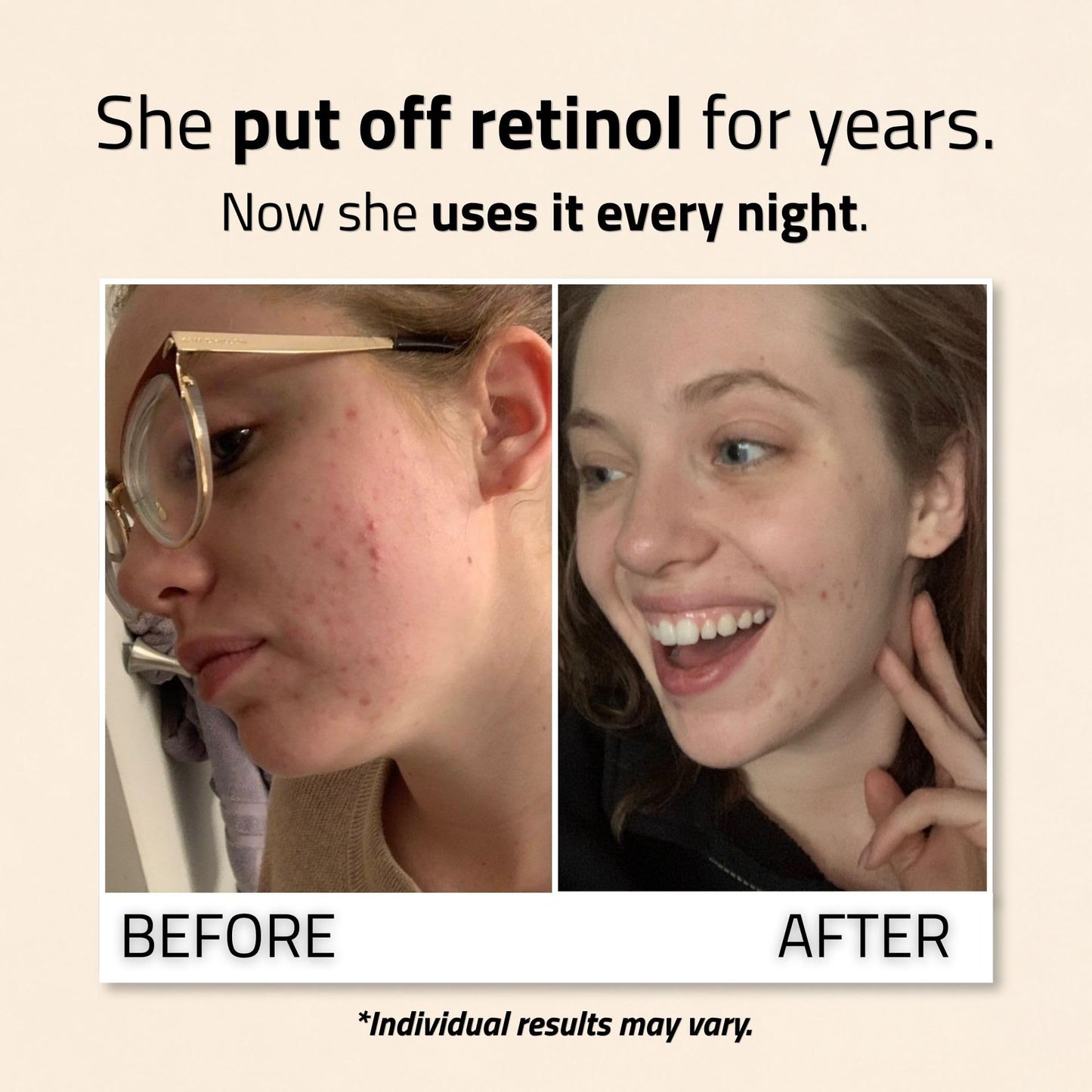 YEOUTH Retinol Serum for Face with Hyaluronic Acid and Vitamin E, Gentle Retinol Skin Booster Serum Targets the Appearance of Fine Lines and Wrinkles Beauty & Personal Care YEOUTH