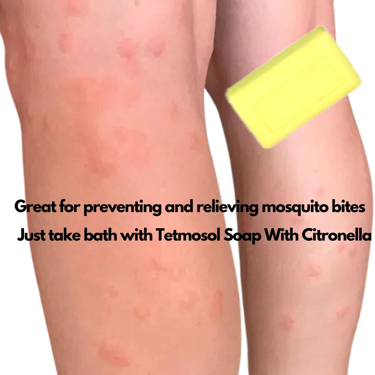 NatoGears Tetmosol Medicated Soap Big Size With Citronella 120g (5)