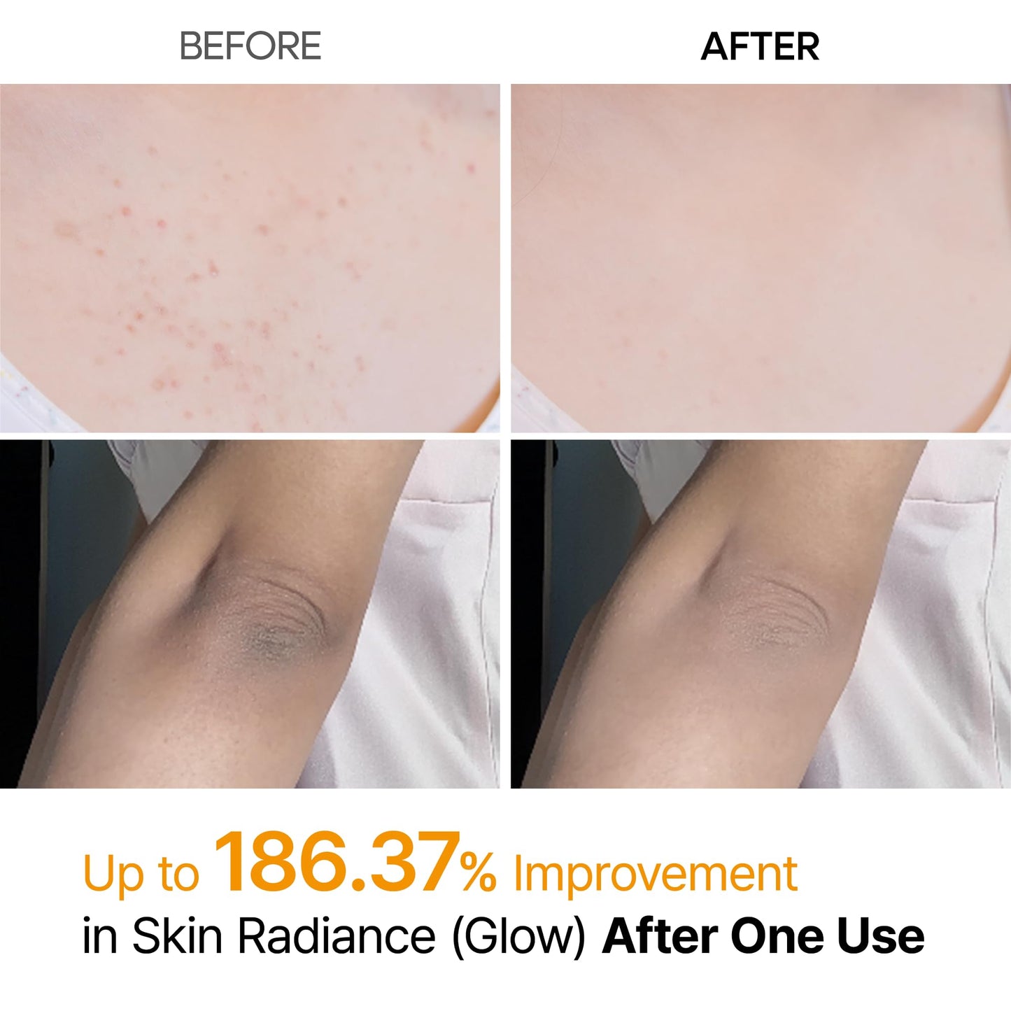 Dr.Melaxin Peel Shot Kojic Acid Turmeric Body Exfoliator Spray 6.76 fl.oz - AHA PHA Niacinamide Body Scrub for KP Bumps, Dark Spots, Uneven Skin Tone Beauty and Personal Care Dr.Melaxin