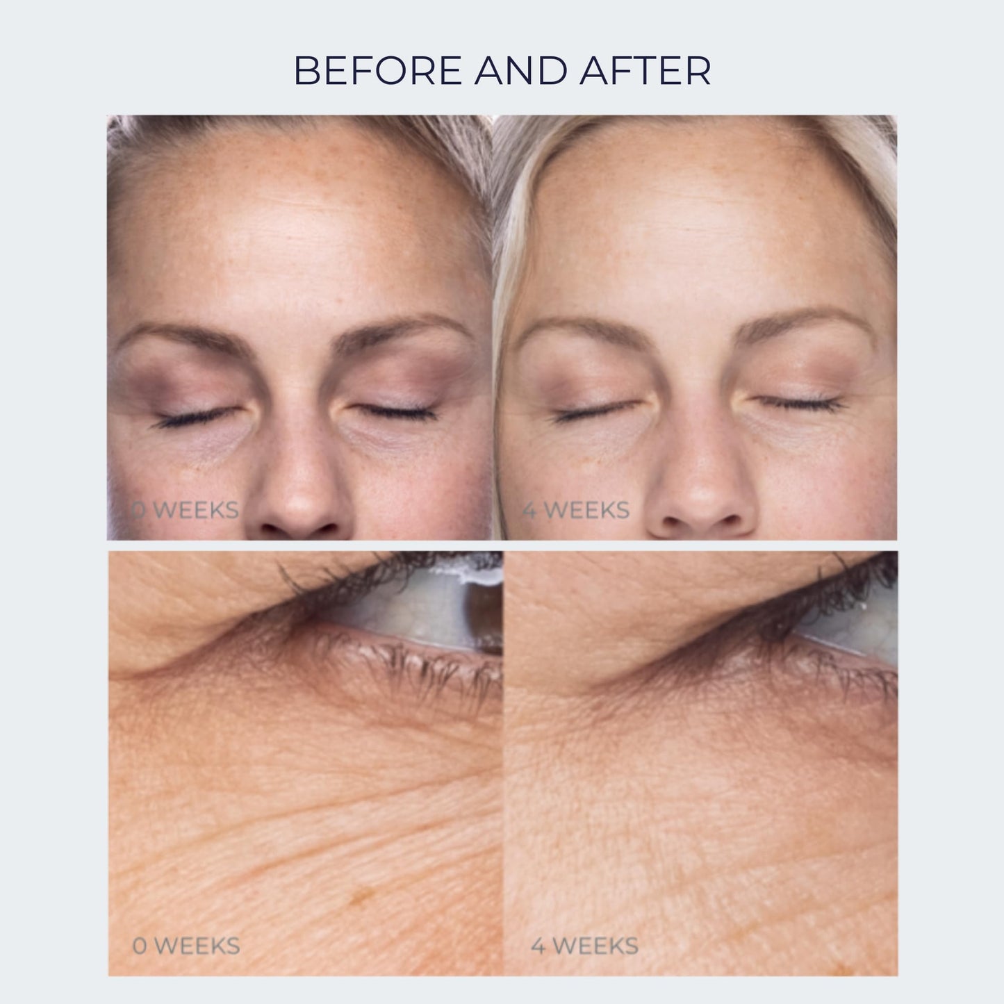 Anti-Aging Peptide Under Eye Cream - Peptide Eye Cream for Hydrated & Firm Skin - Under Eye Cream for Dark Circles and Puffiness - Anti Aging Eye Beauty & Personal Care Alana Mitchell